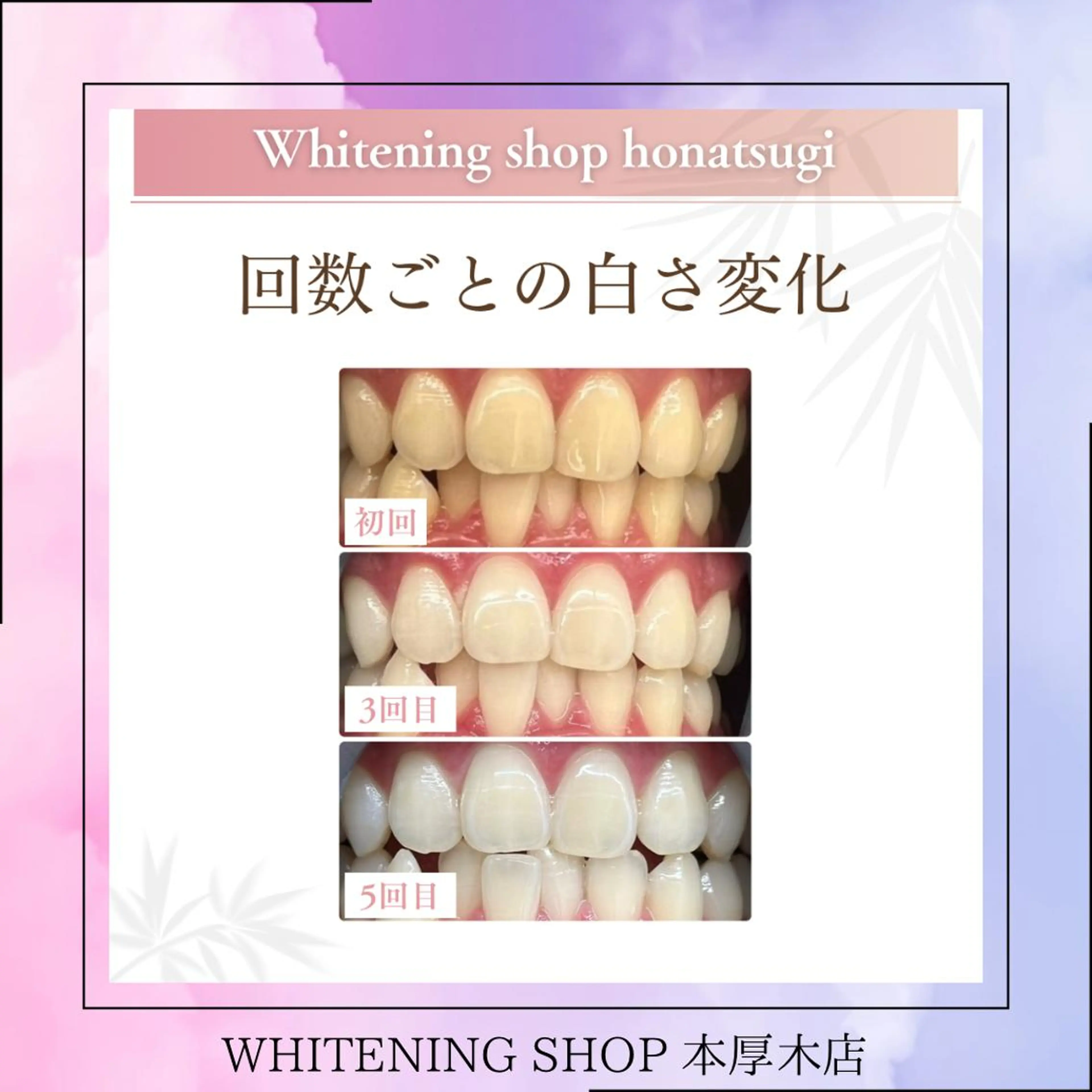 メンズ その他 ホワイトニング ショップ本厚木のその他イメージ