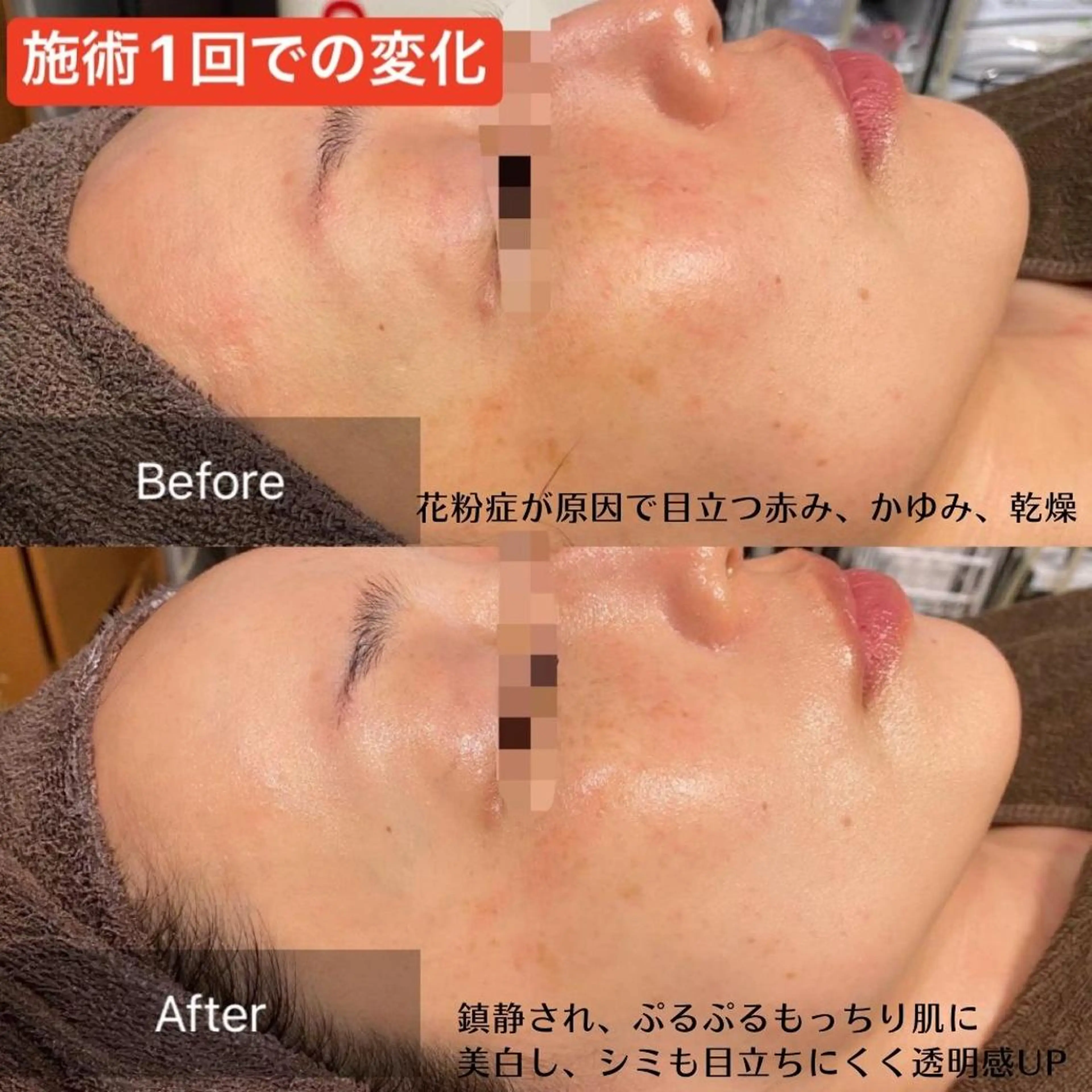 ビューティースリム reborn 新宿店のエステ・リラクイメージ