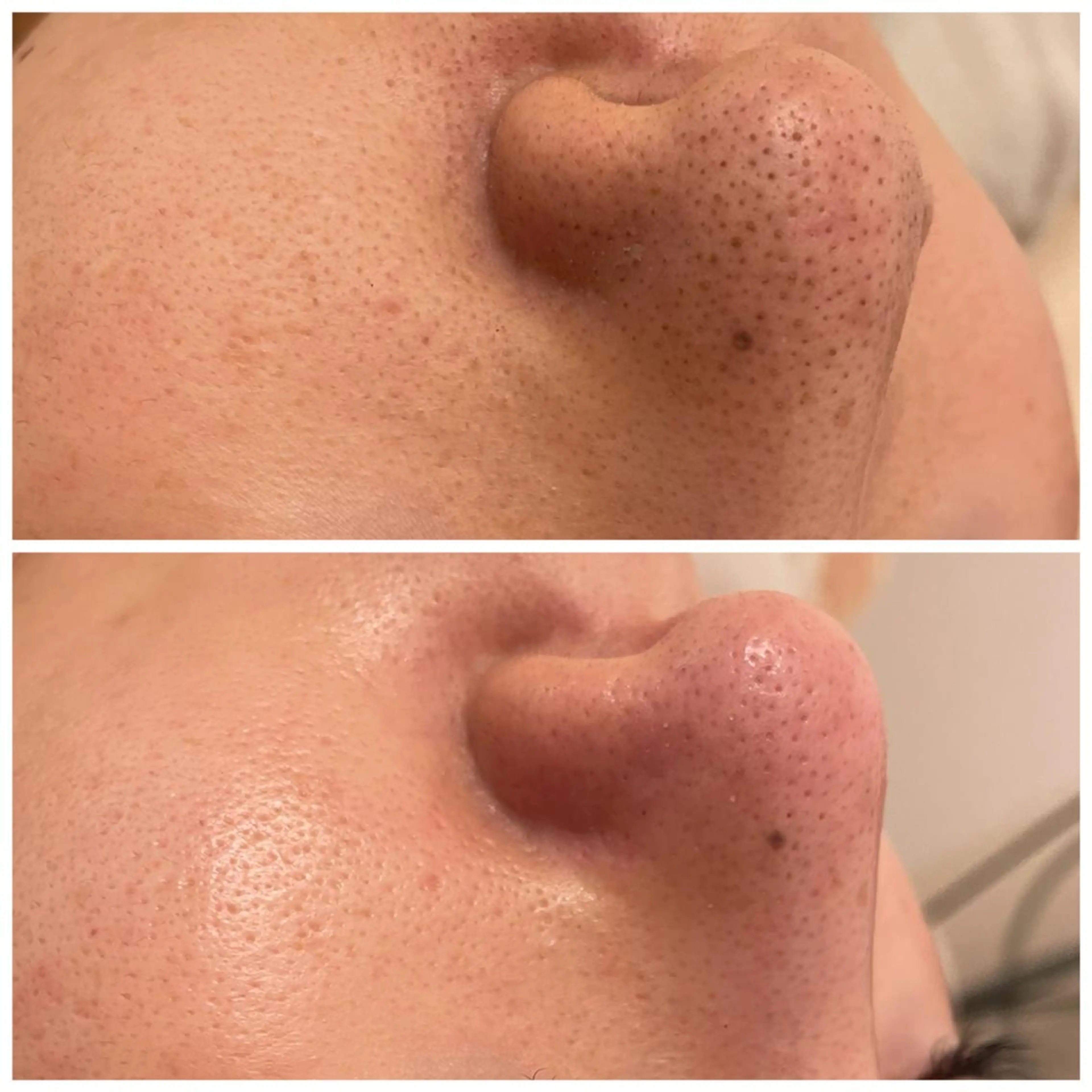 エステ ララ/ハーブ メゾンリュバンのエステ・リラクイメージ