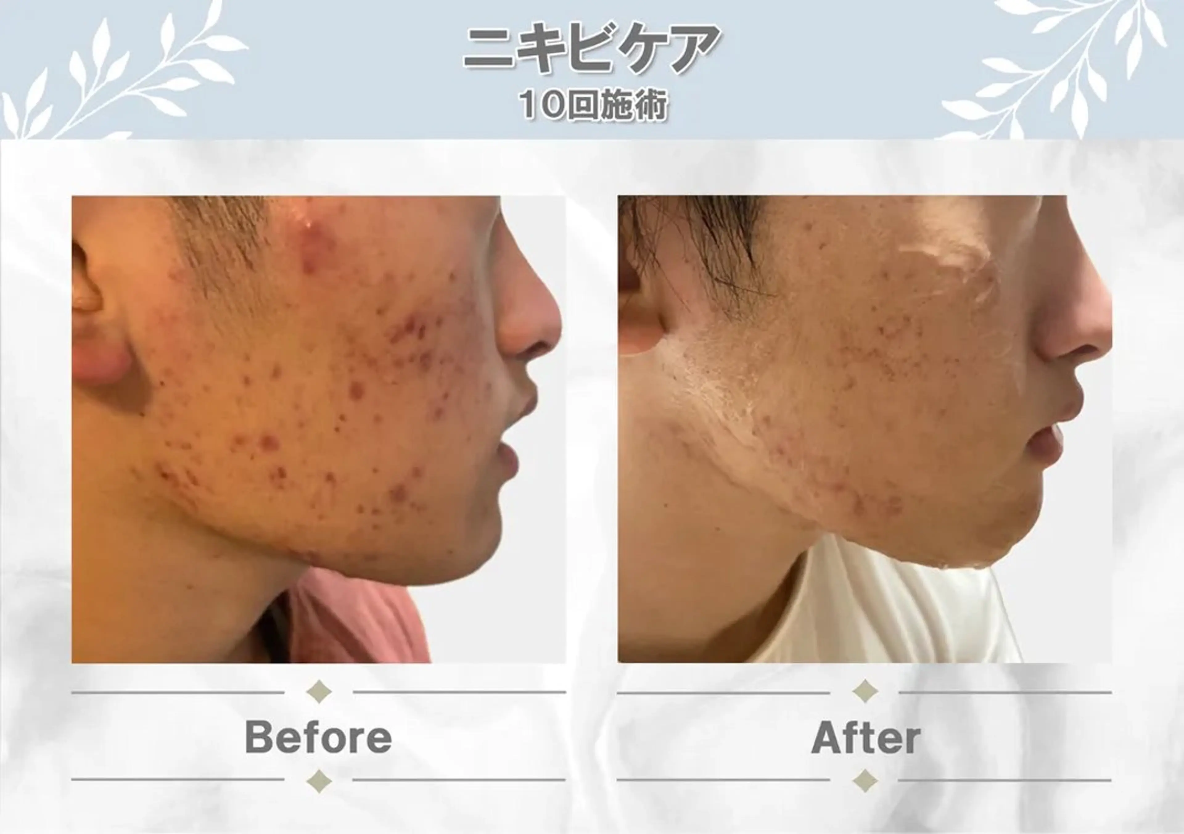 エステ MODE K's 白石彩夏のエステ・リラクイメージ