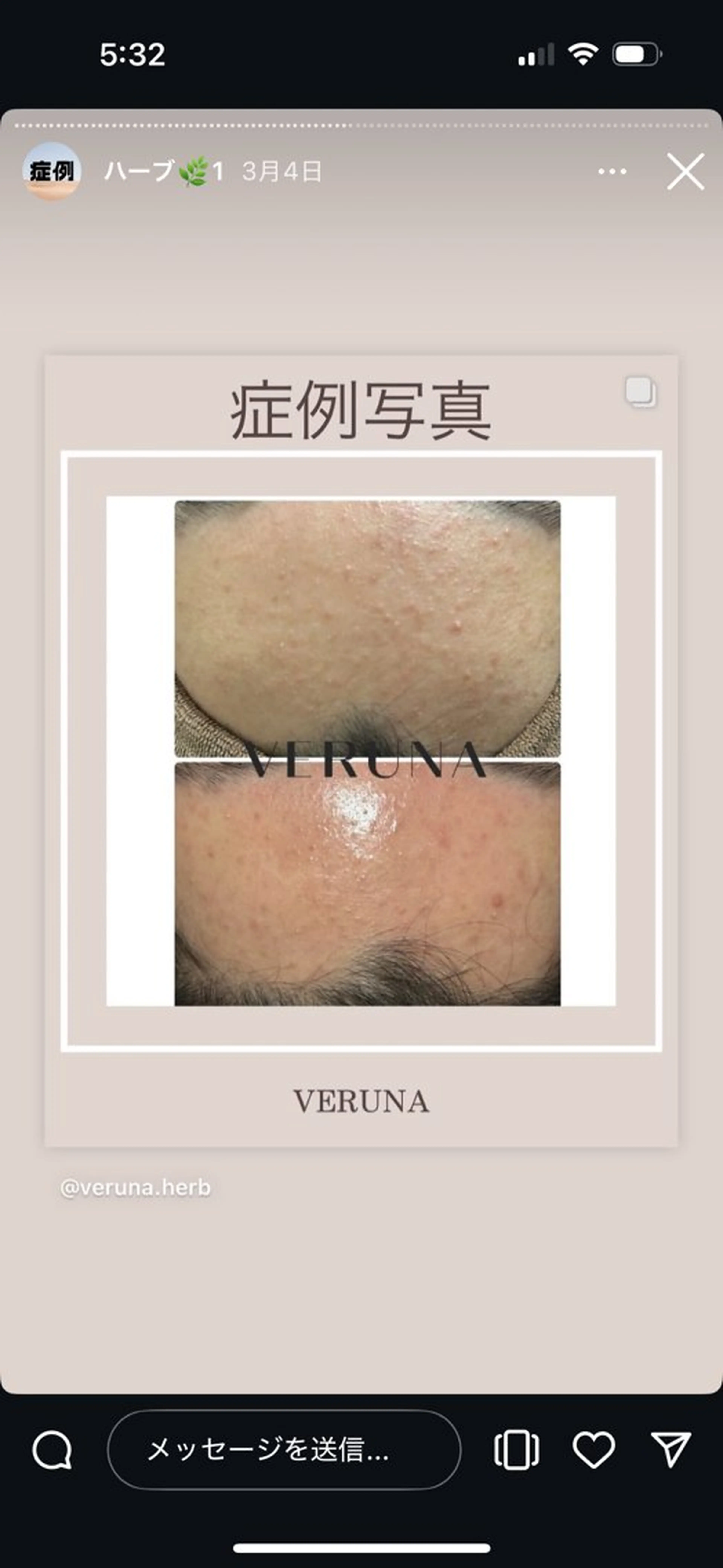 エステ ハーブピーリング専門 グランディール　武内のエステ・リラクイメージ