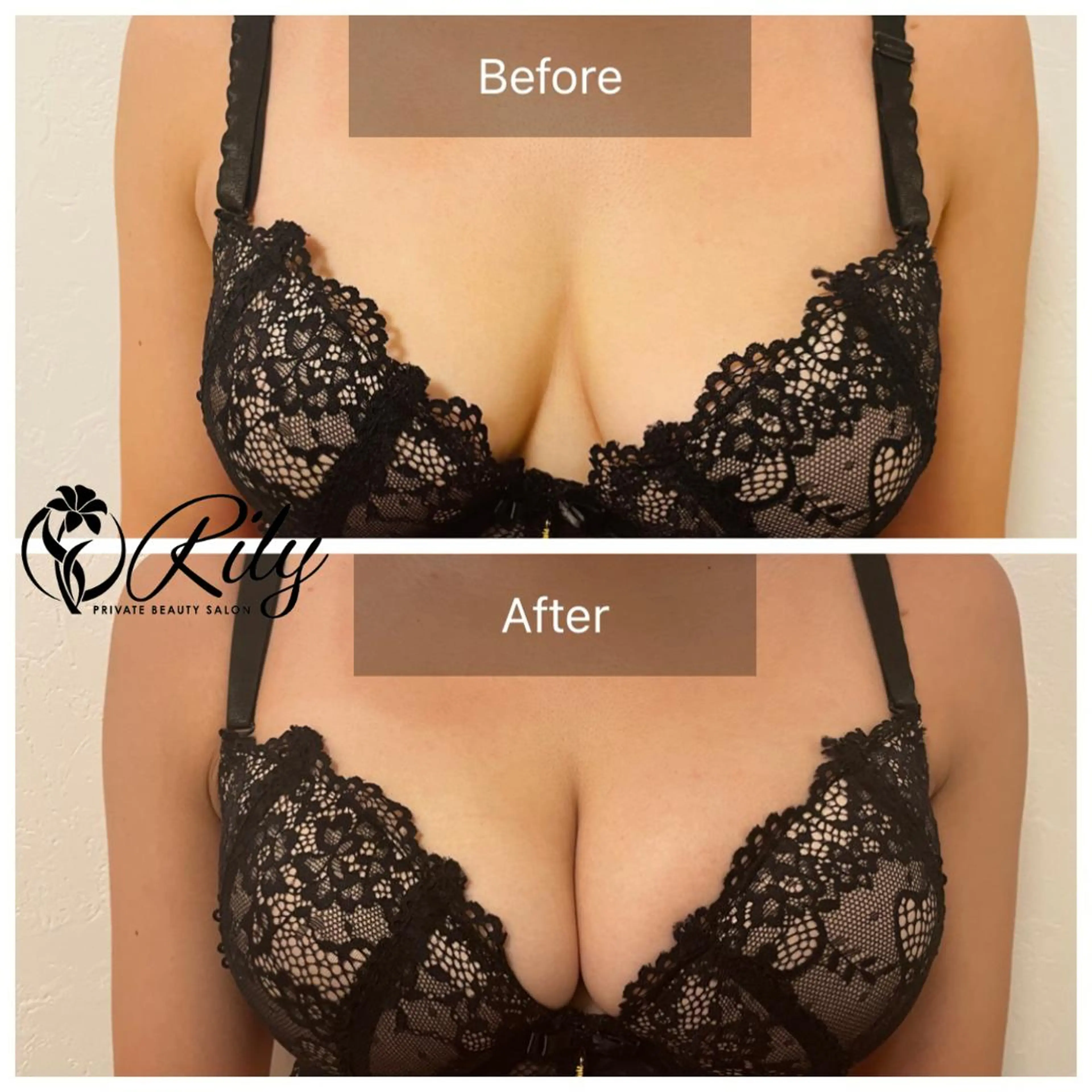 エステ プライベートサロン RILYのエステ・リラクイメージ