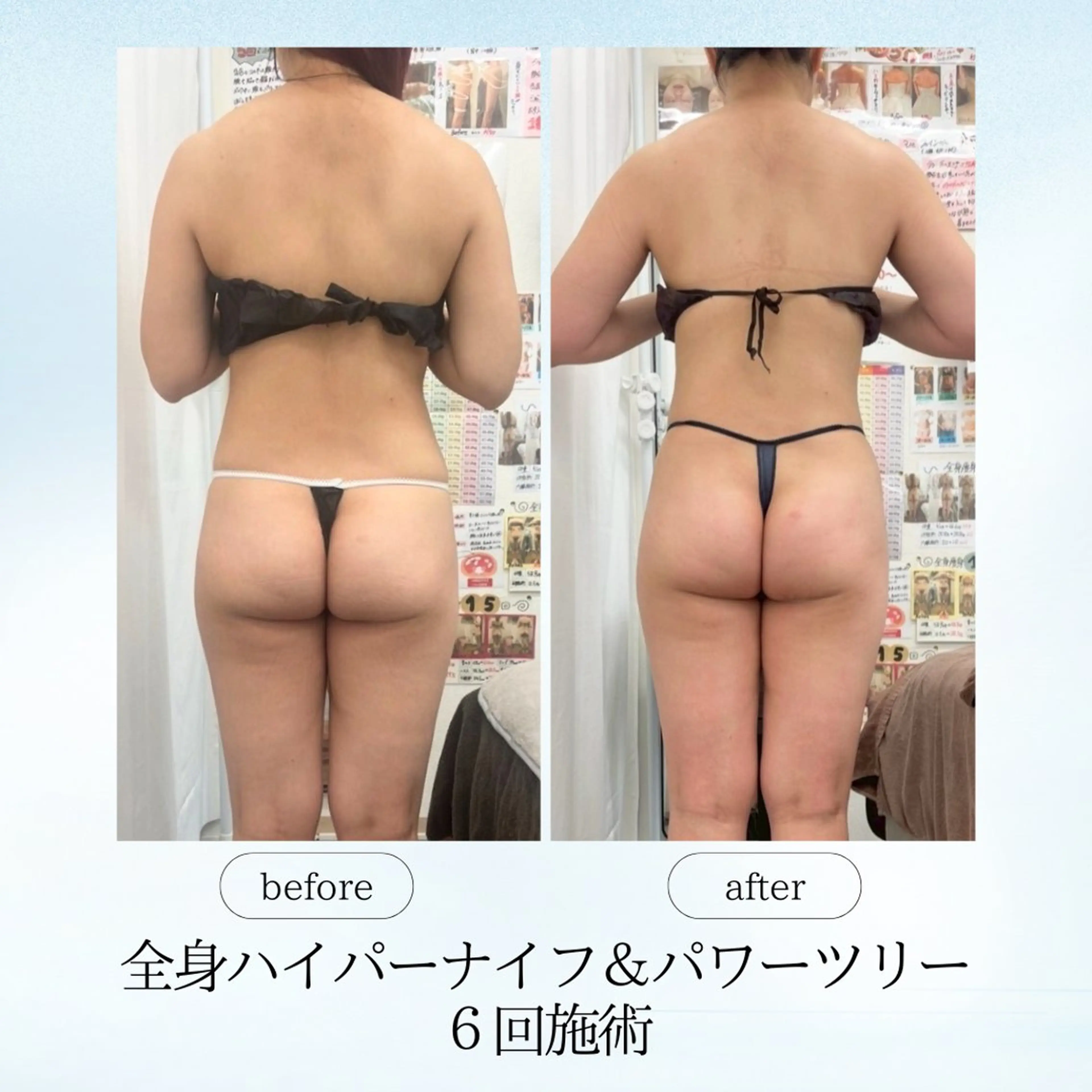 エステ リラク espresso,所属・《痩身、小顔専門店》 エスプレッソのエステ・リラクイメージ