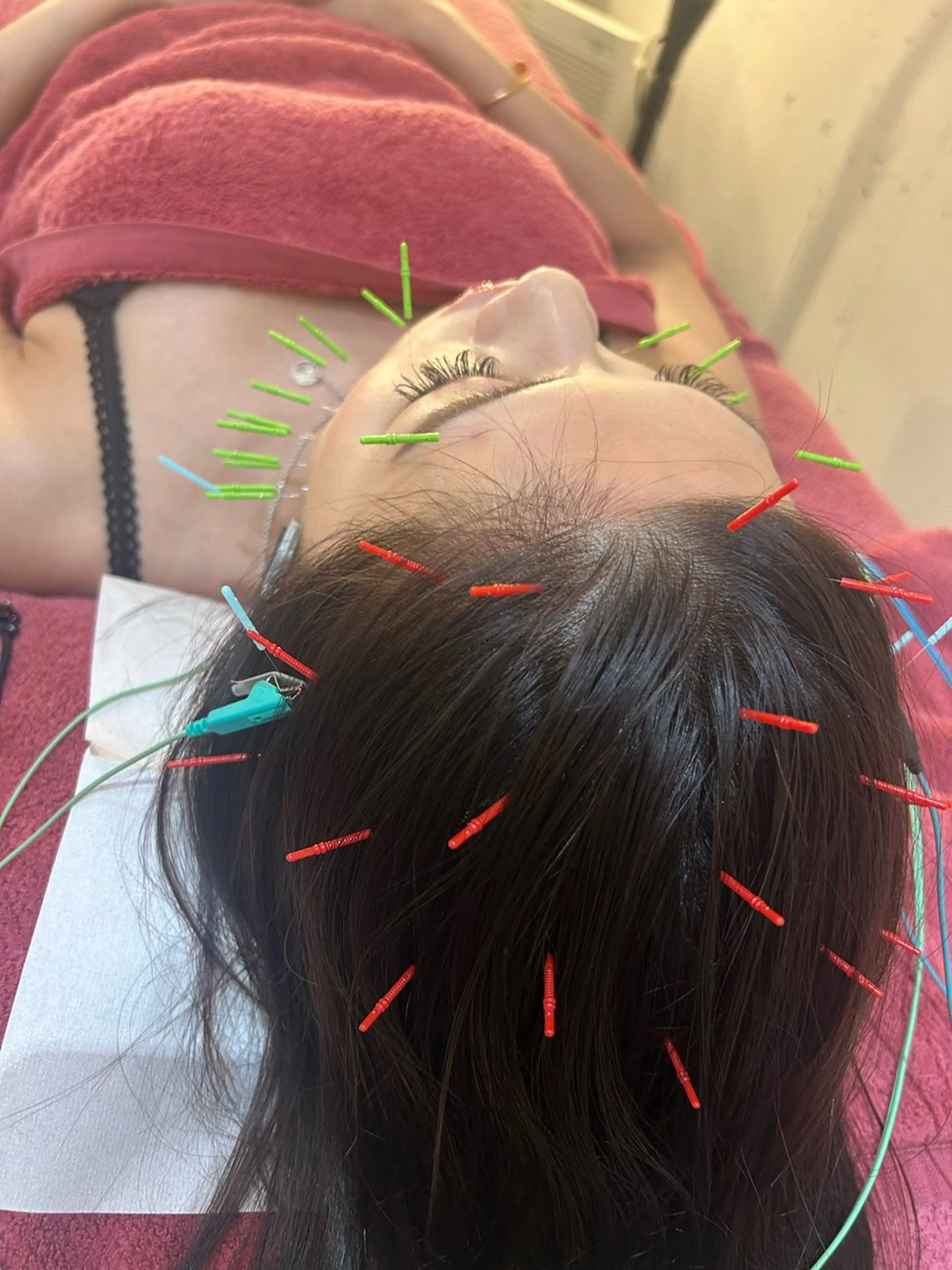 エステ リラク 美容鍼灸女性専用 りんご鍼灸治療院のその他イメージ