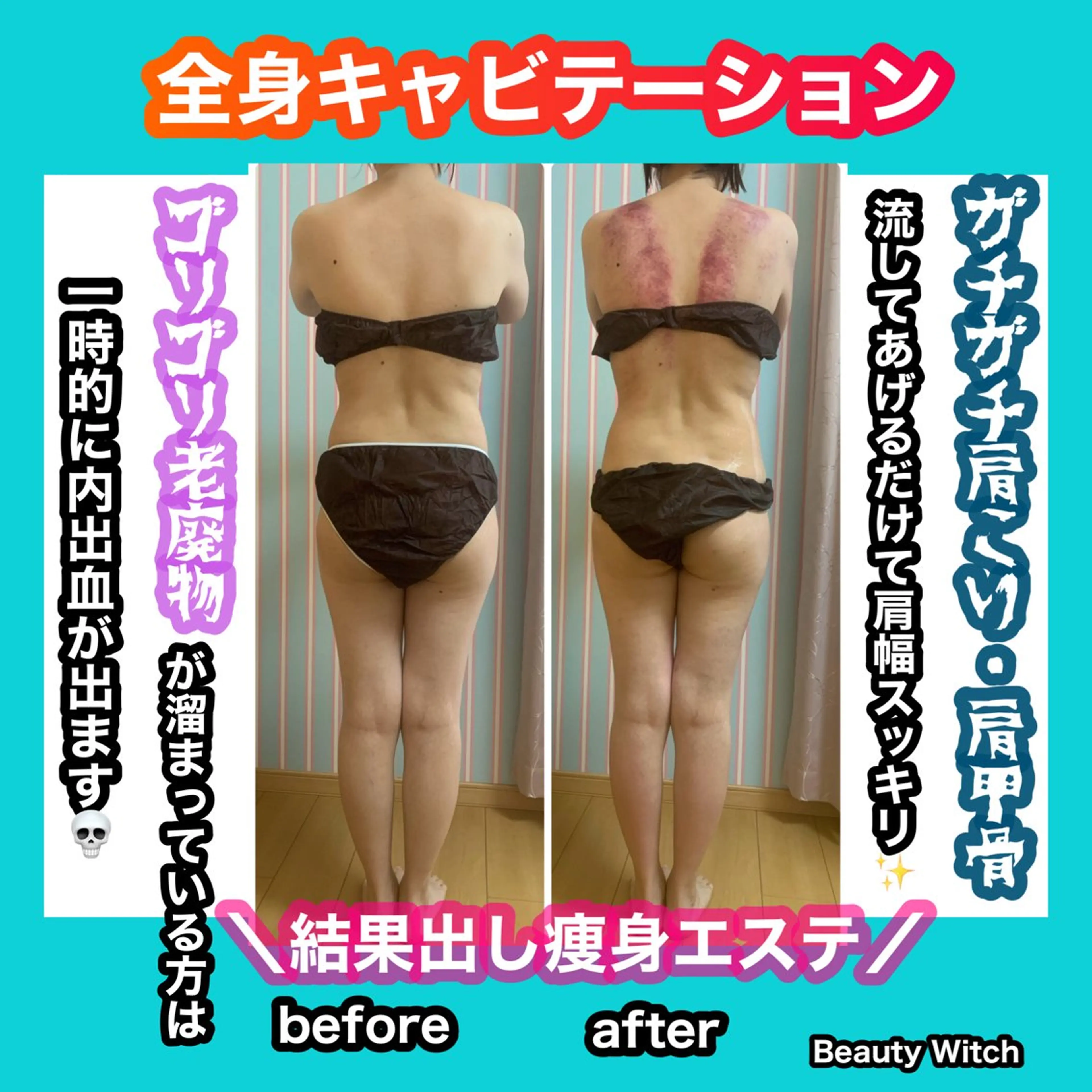 エステ リラク 痩身/脱毛/ネイル HARUKAのエステ・リラクイメージ