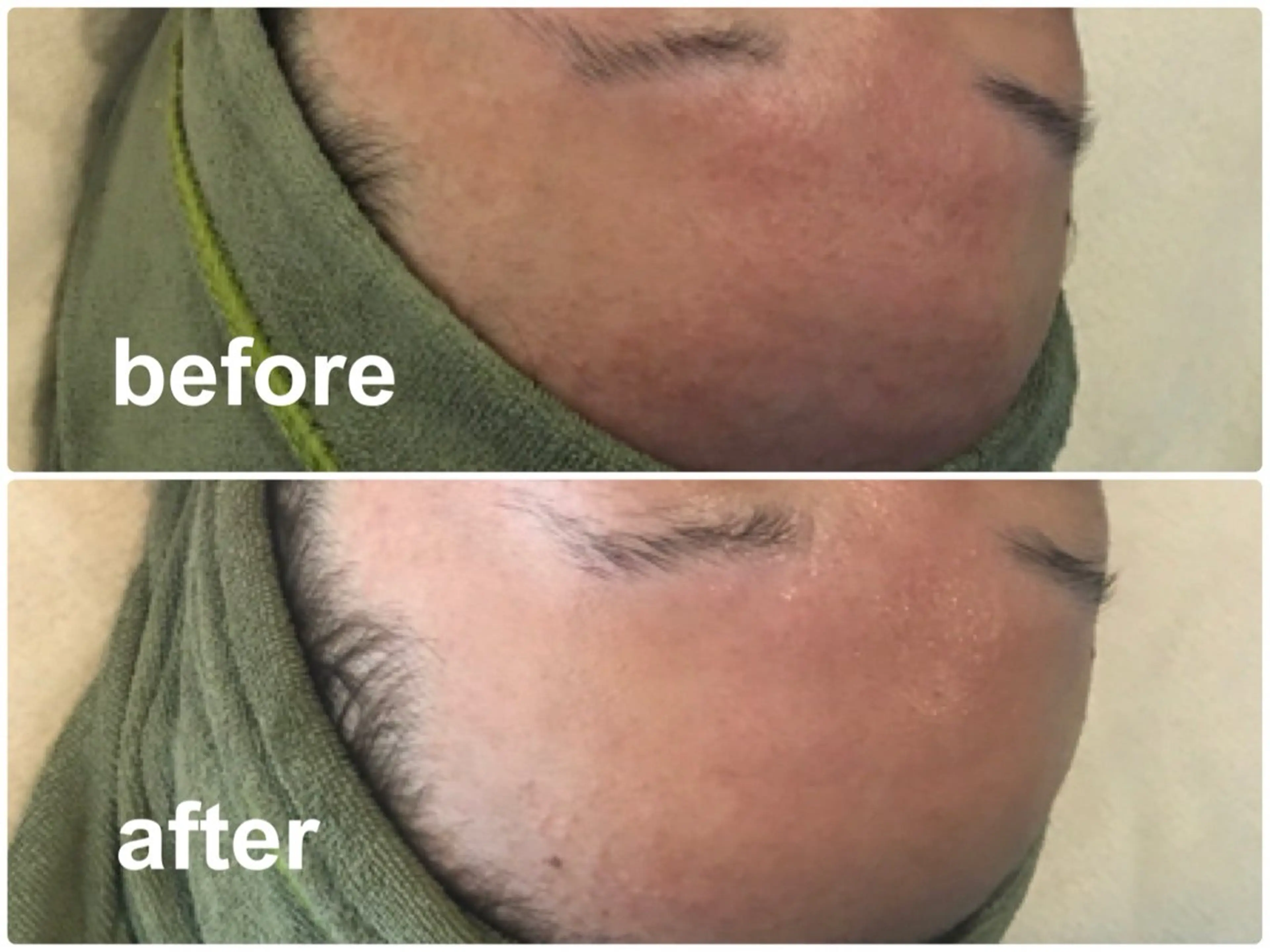 ブライダルエステ専門 入谷友莉のエステ・リラクイメージ