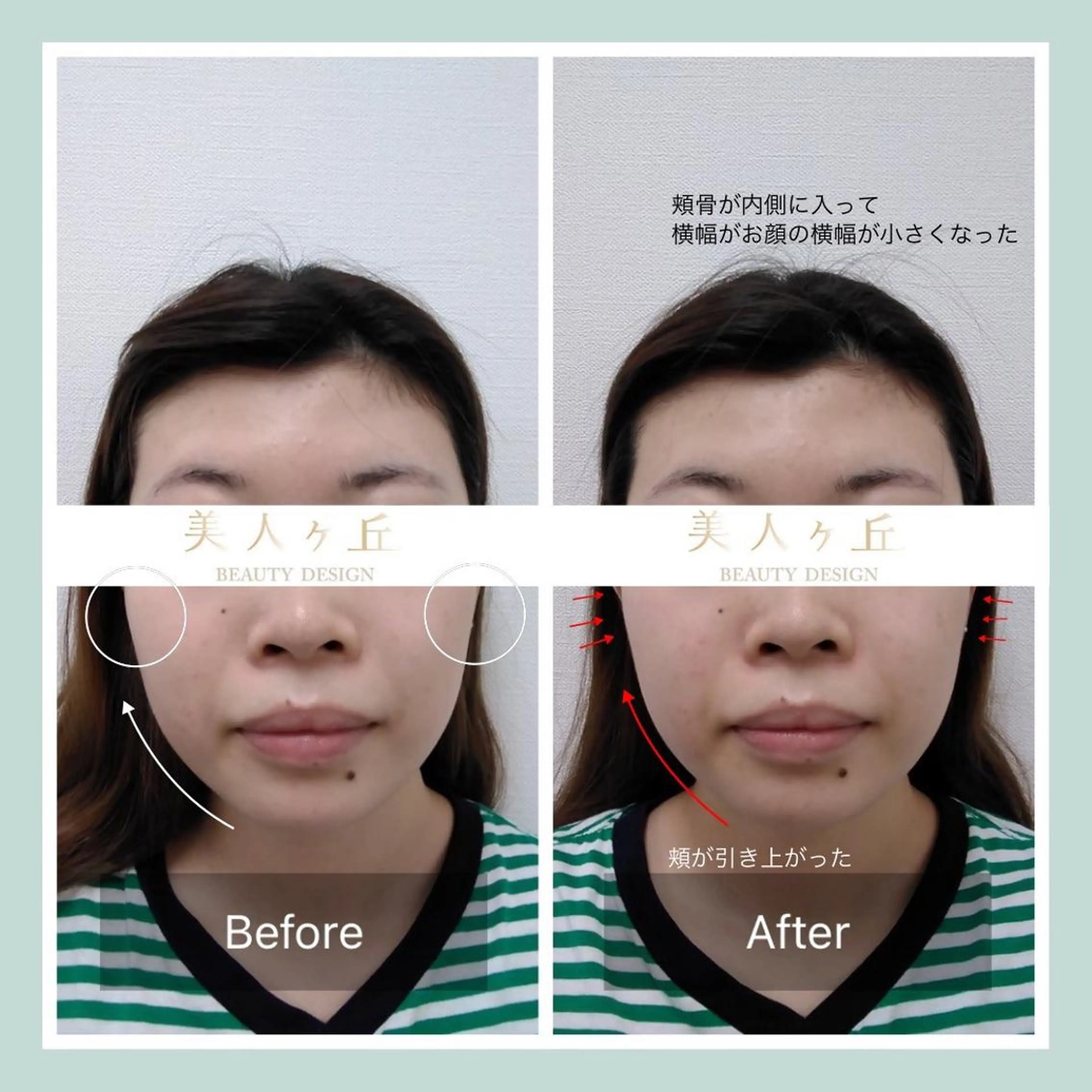 韓国/ヌーディー系 ネイル自由が丘のネイルデザイン