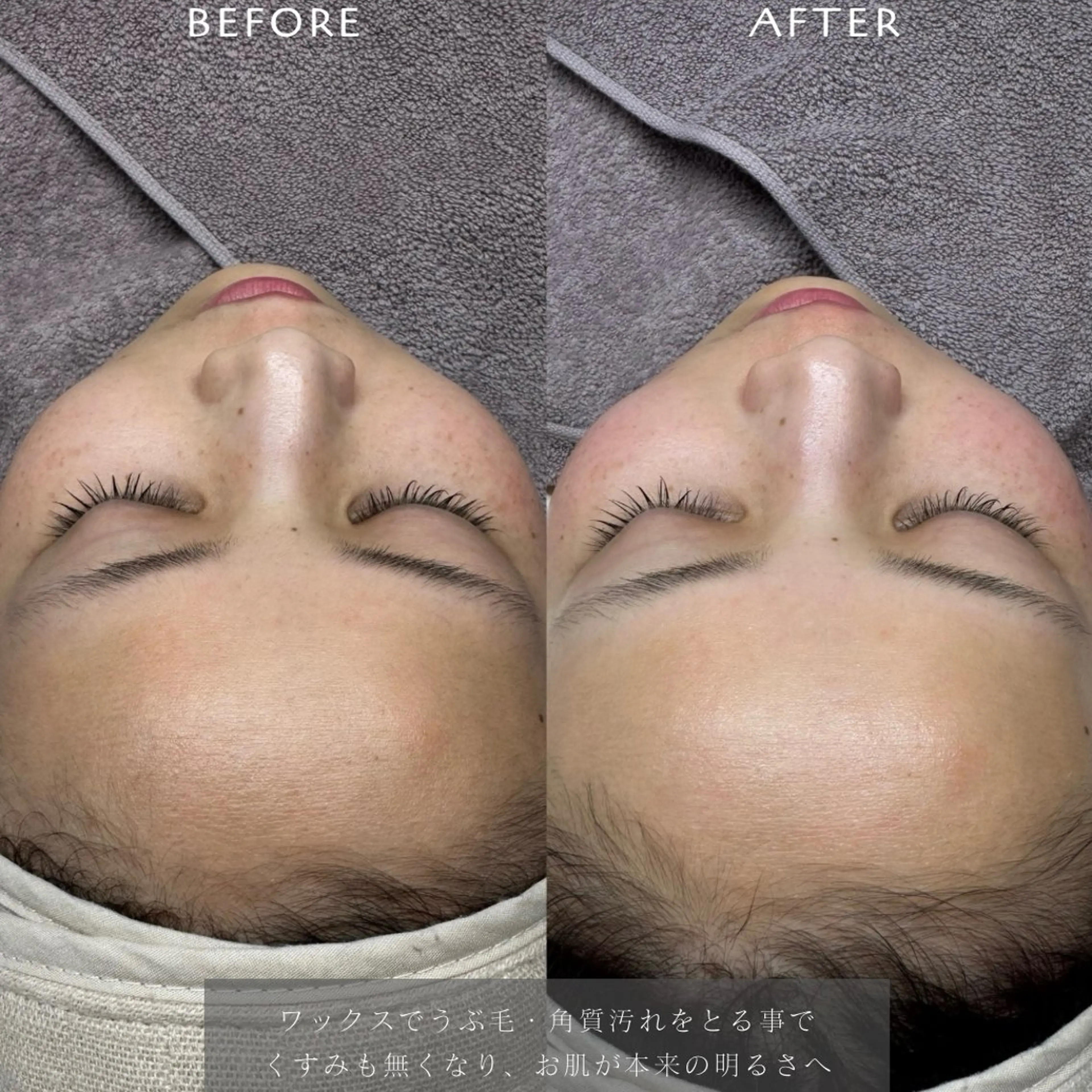 脱毛 フェイシャルワックス KANAKOのエステ・リラクイメージ