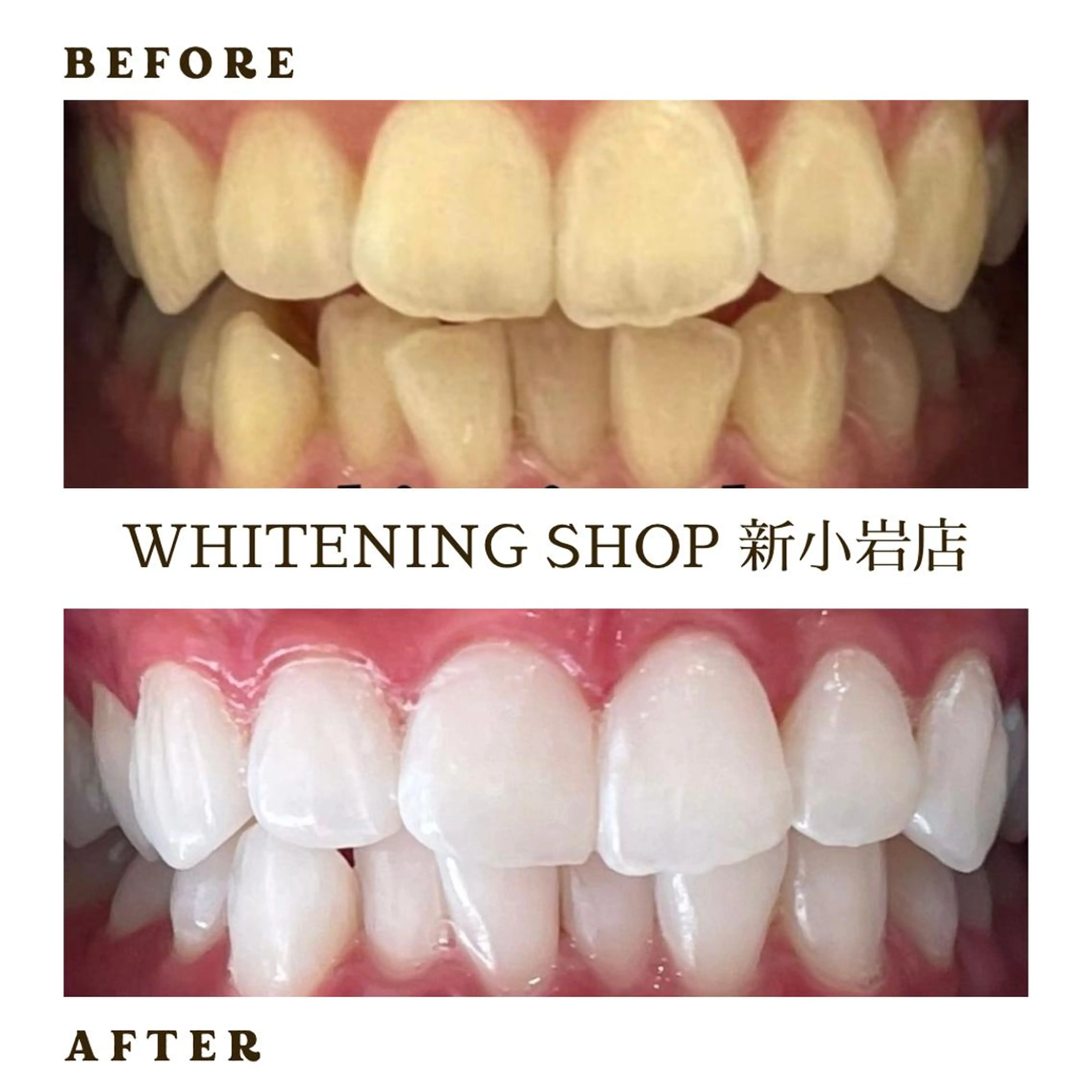メンズ 学生（メンズ向け） その他 ホワイトニング ショップ新小岩店のその他イメージ