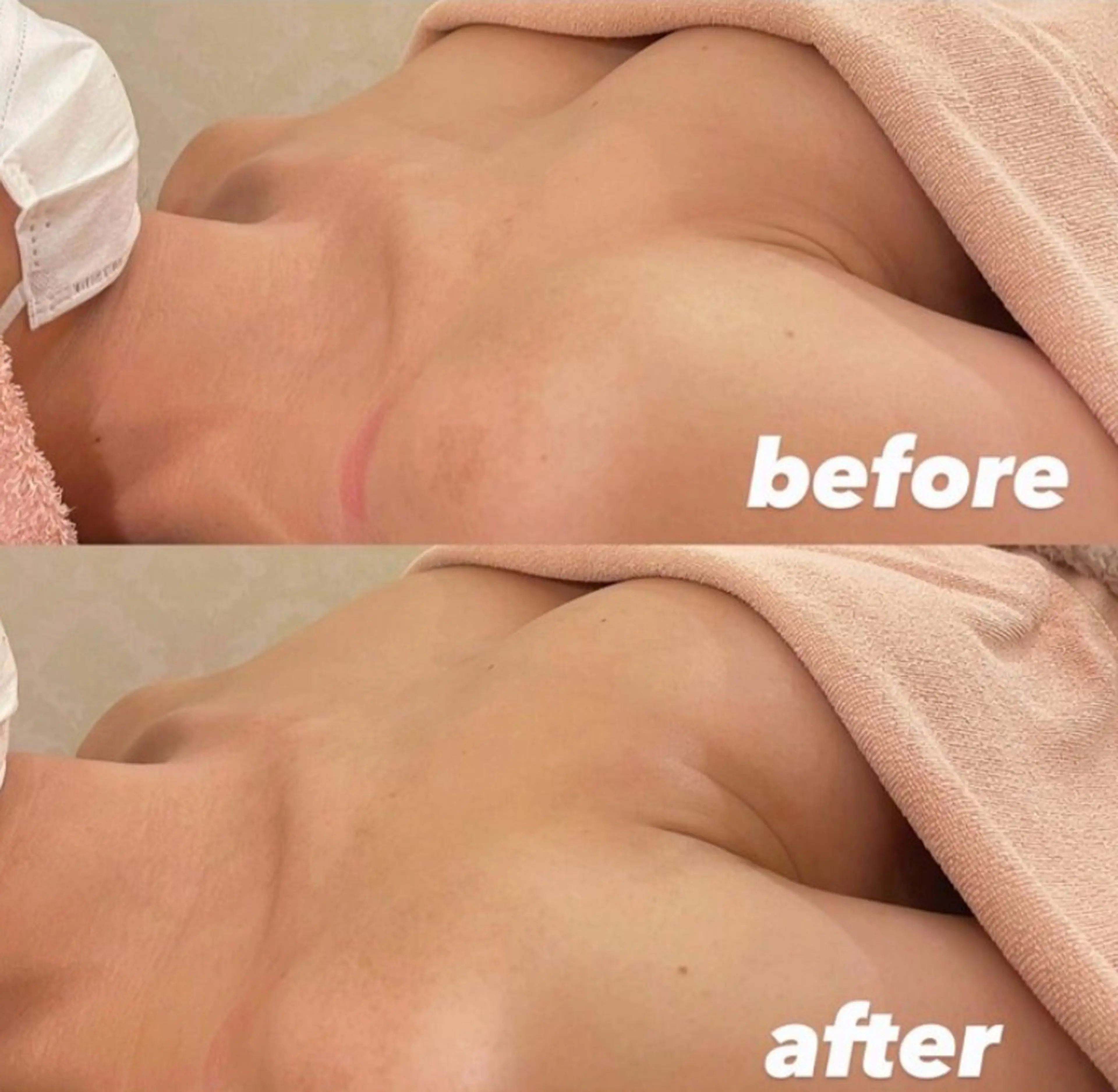 【手技満足度No.1】ボリュームアップ育乳ケア120分/贅沢お手入れ/泡クレイジング&バンテージ¥30000→¥8000の写真