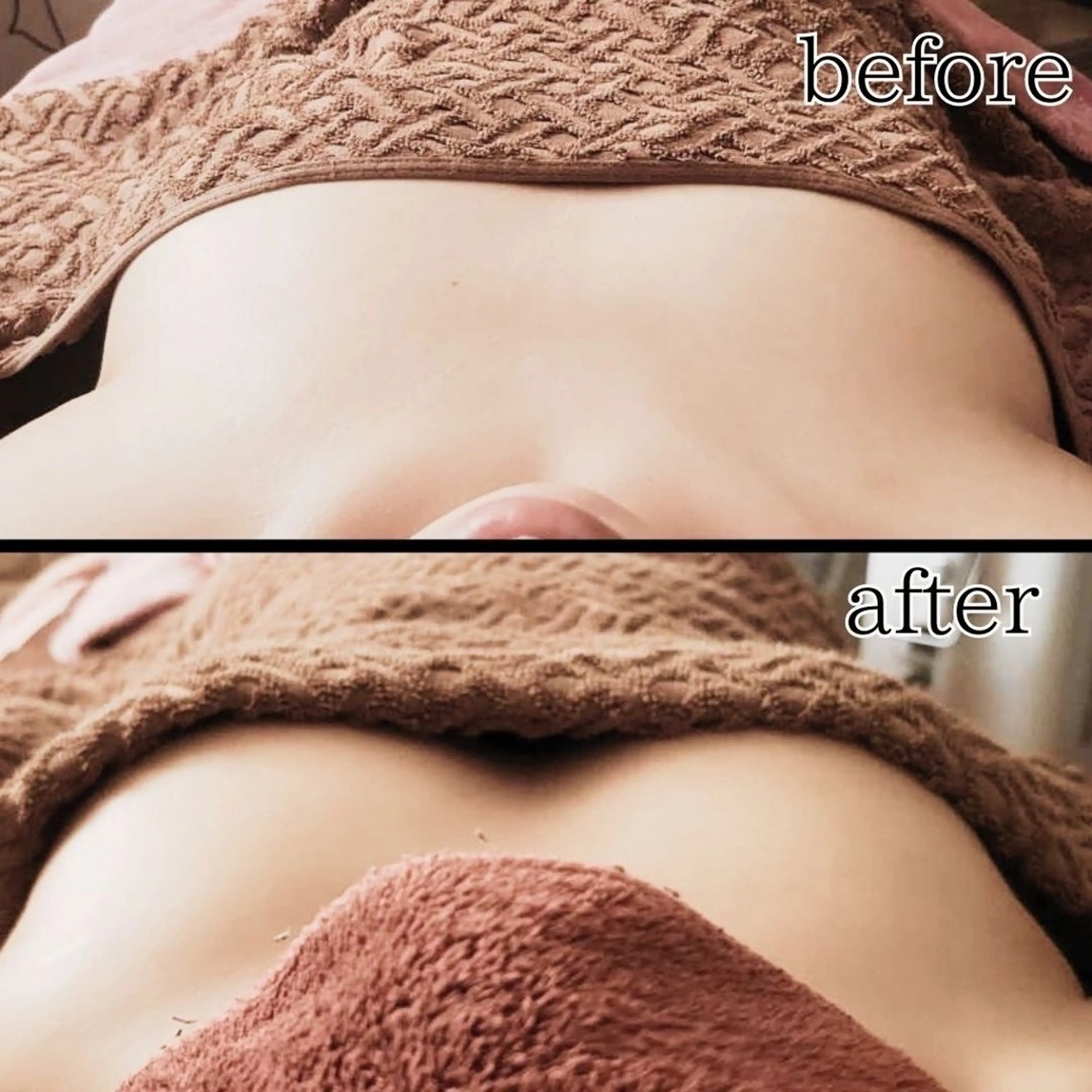 エステ 切らない脂肪吸引🔥 Neroliまりこのエステ・リラクイメージ