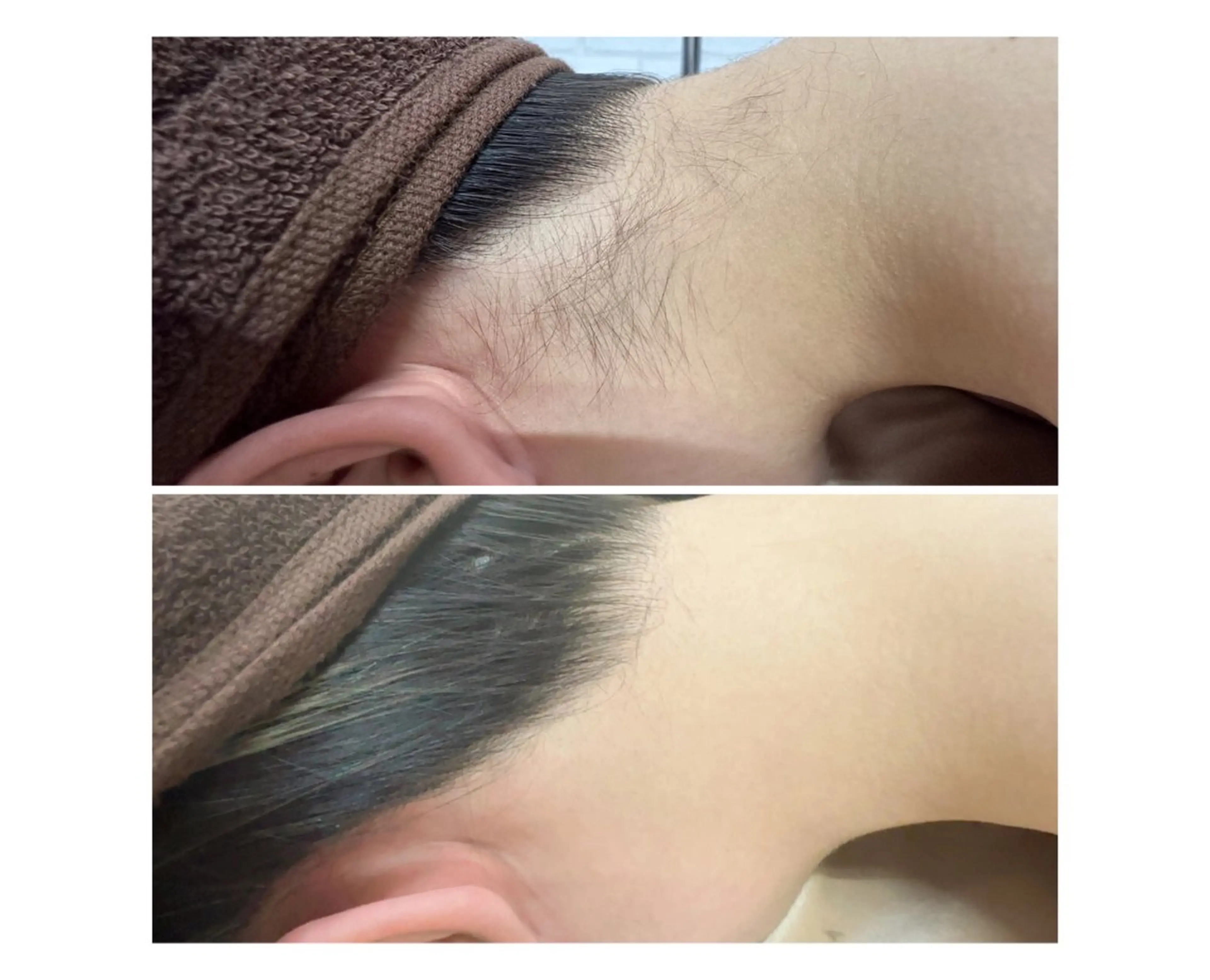 ツヤ肌脱毛サロン Grast🌿アイカのエステ・リラクイメージ