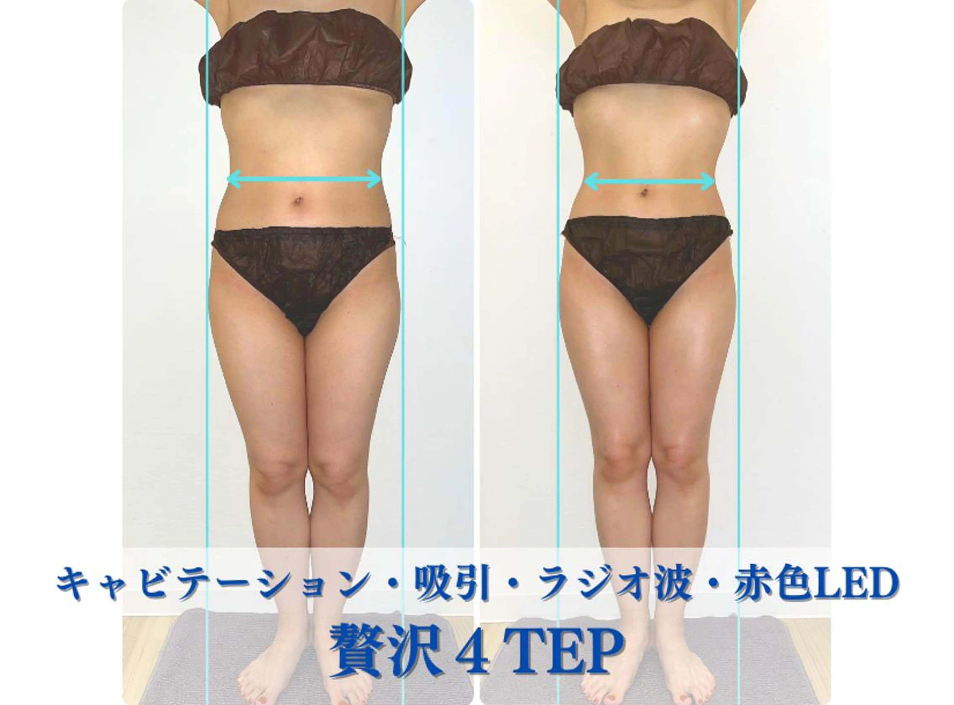 学芸大学 ベルミーランドのエステ・リラクイメージ