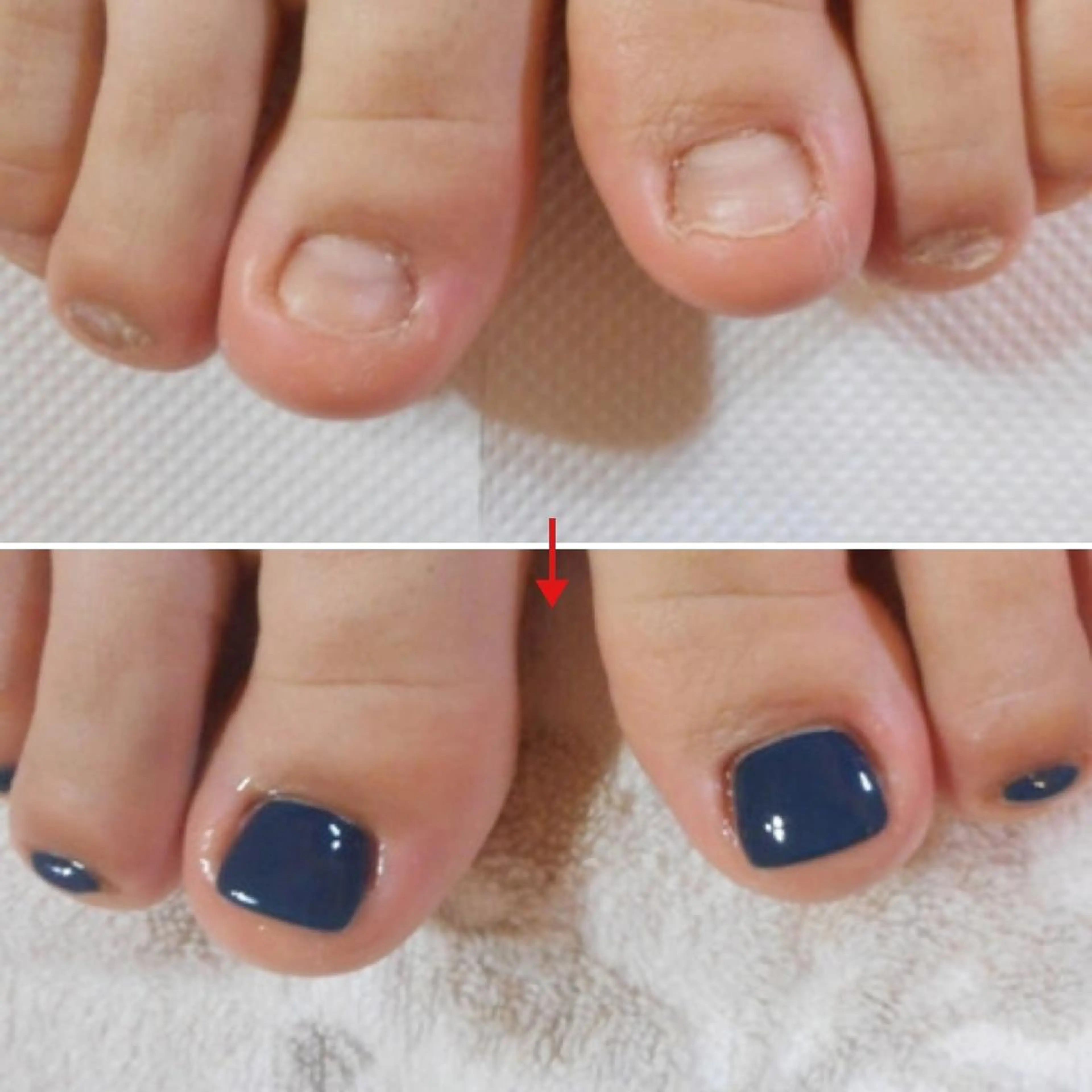 ネイル ネイルサロン アリュームのネイルデザイン