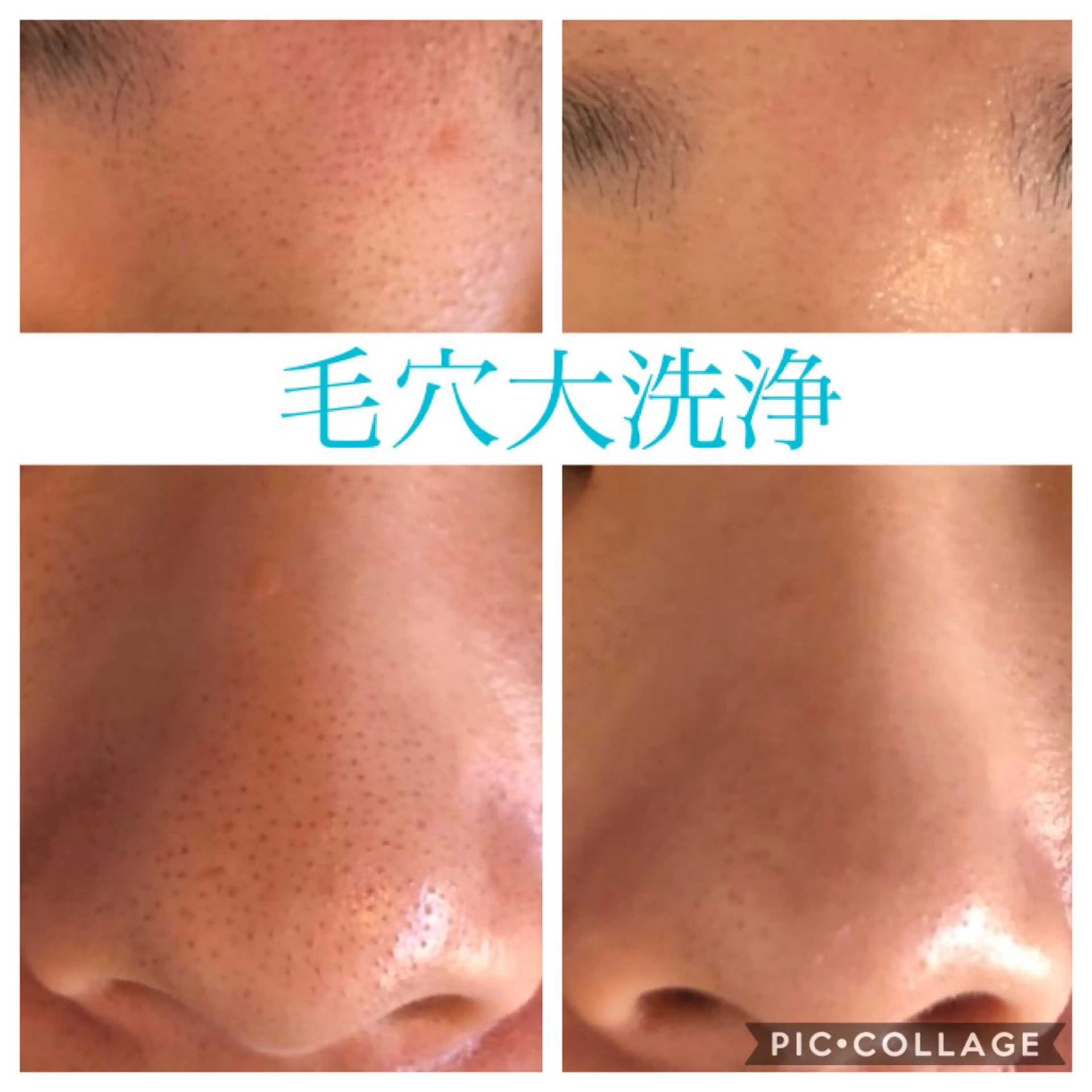 セミロング カラー パーマ ヘアアレンジ キッズ ネイル マツエク・マツパ EnsorClair 代表　野口真央のエステ・リラクイメージ