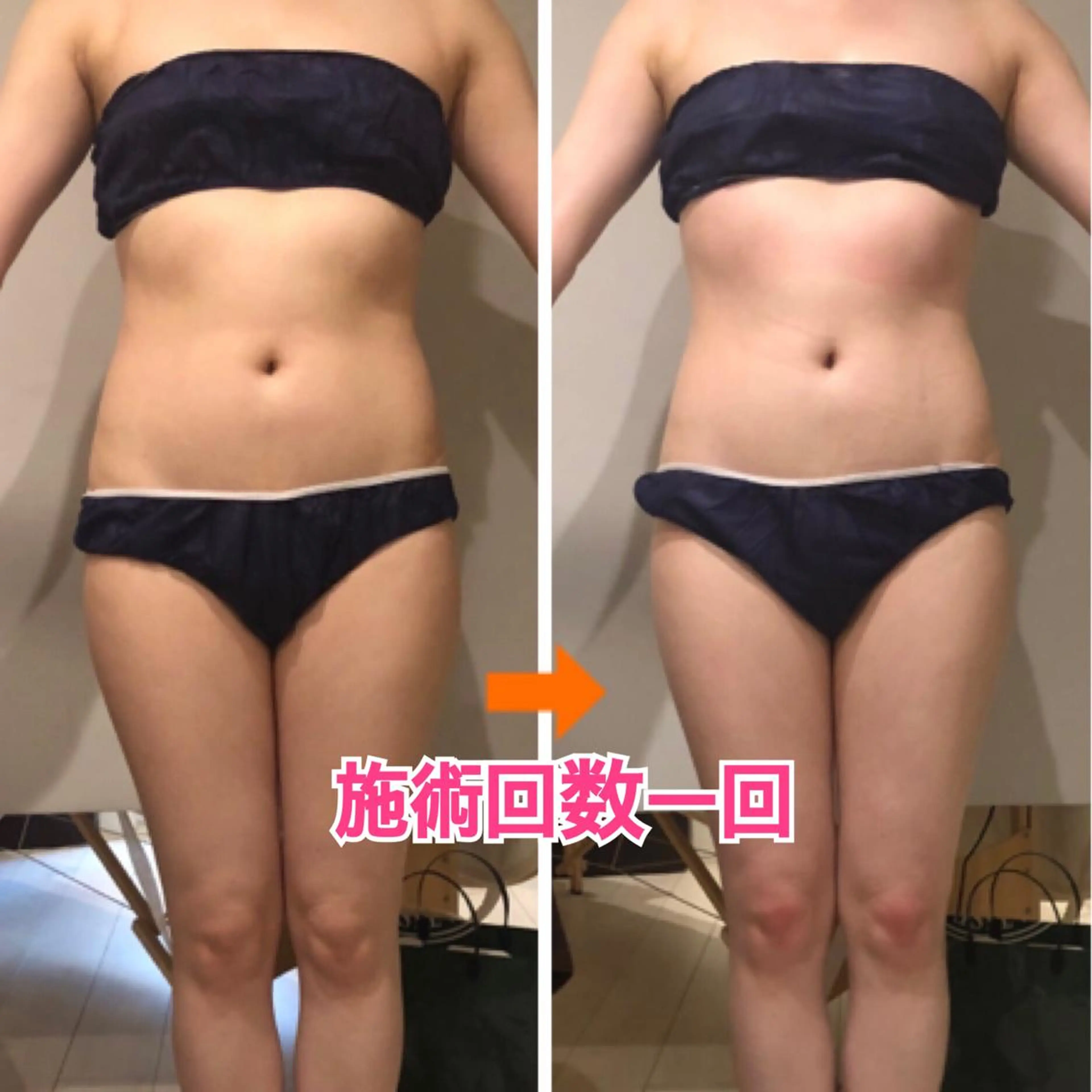 ロング カラー パーマ ヘアアレンジ メンズ キッズ ネイル マツエク・マツパ ‍痩身＆ボディ 結果出し🌟丹野のエステ・リラクイメージ