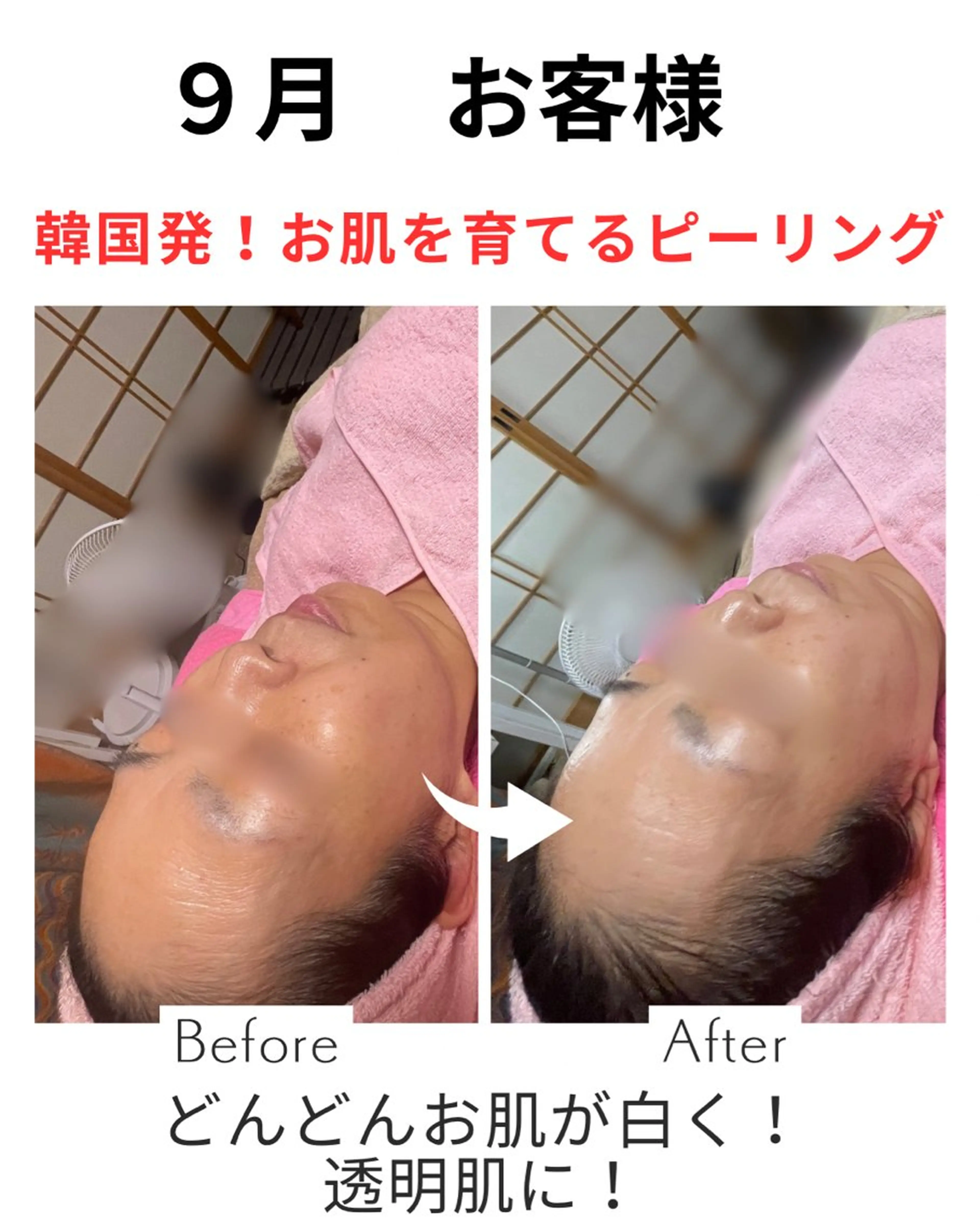 エステ 韓国肌&ララピール シミケア　せんすのエステ・リラクイメージ