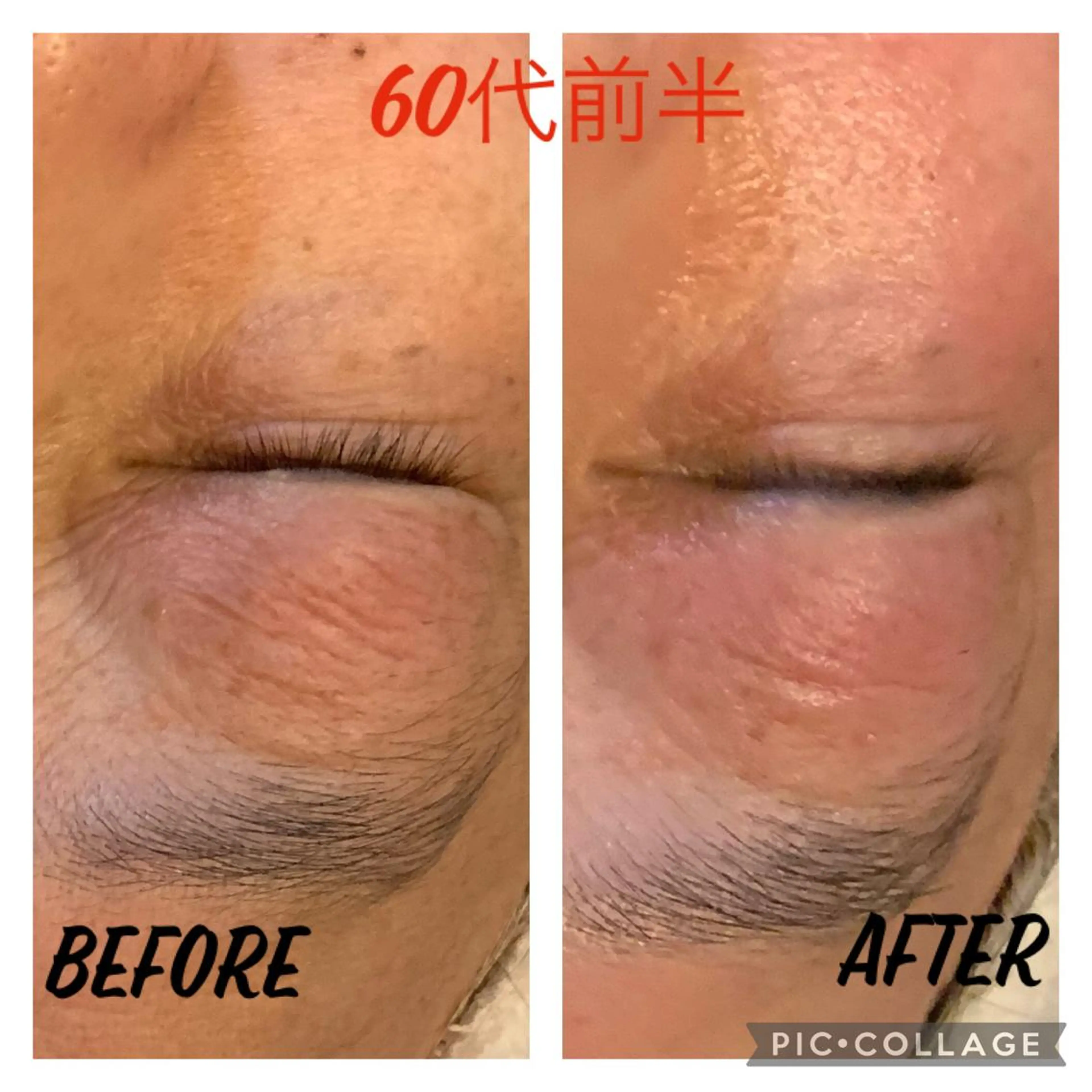 引き上がりすぎ注意⚠️幹細胞パック付!老化知らずのお肌へ、、、の写真