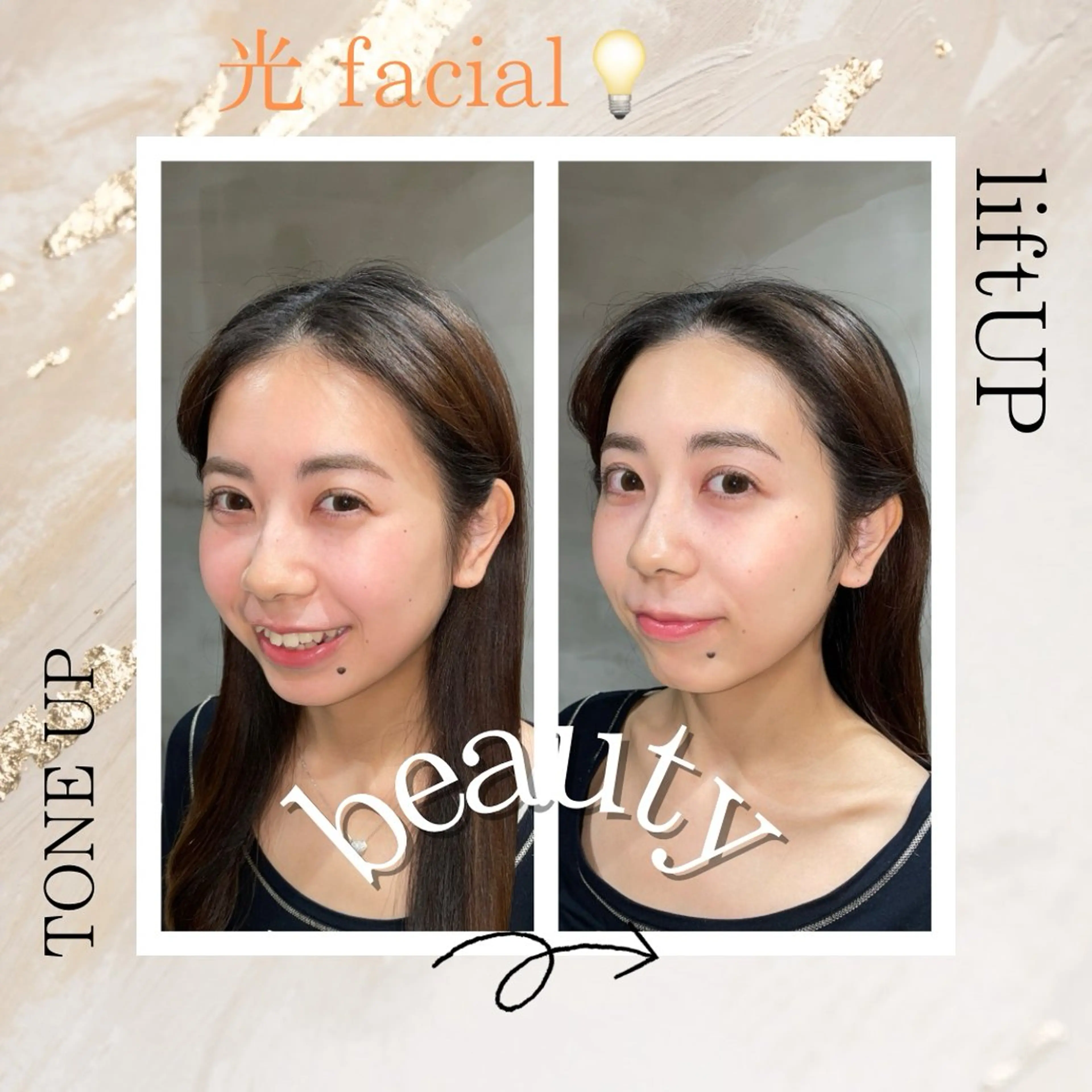 エステ 🎀kaede🎀 骨格似合わせ眉毛の眉毛・アイブロウイメージ