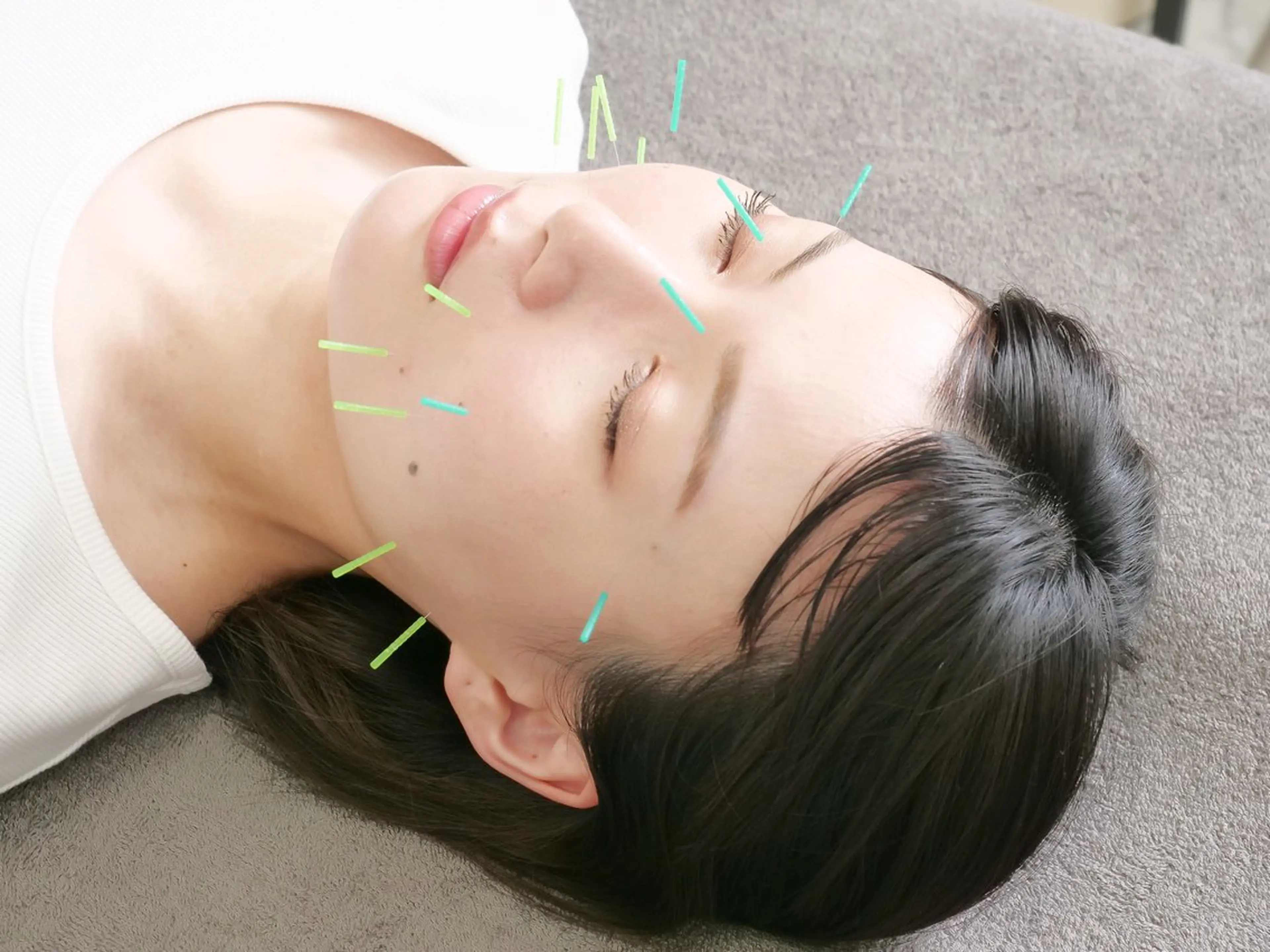 美容鍼×小顔矯正 ×美容整体　浜川泰仁のエステ・リラクイメージ