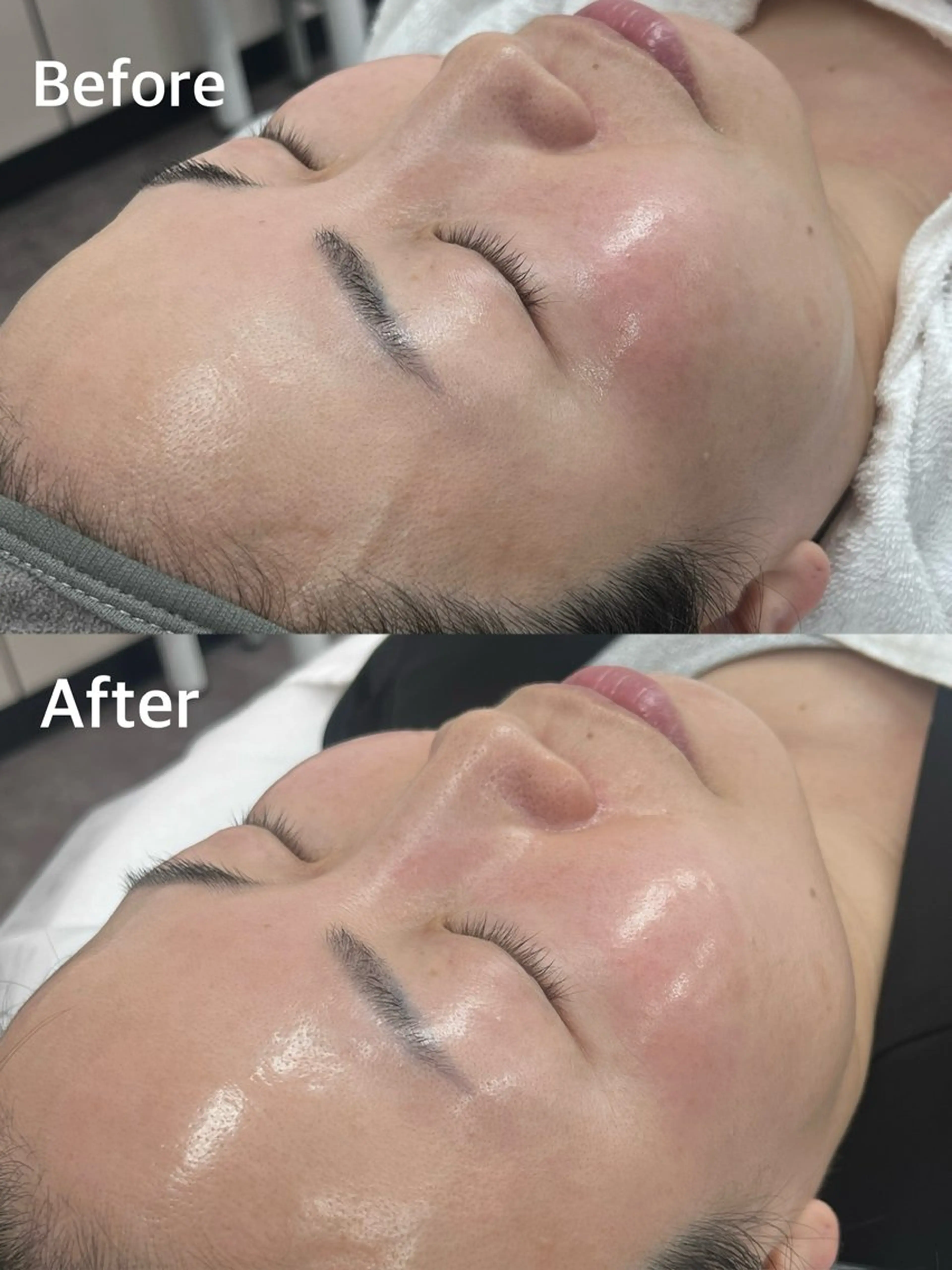 小顔専門看護師クリニカルサロンCOCO所属・小顔と美肌サロン クリニカルサロンココのエステ・リラクイメージ