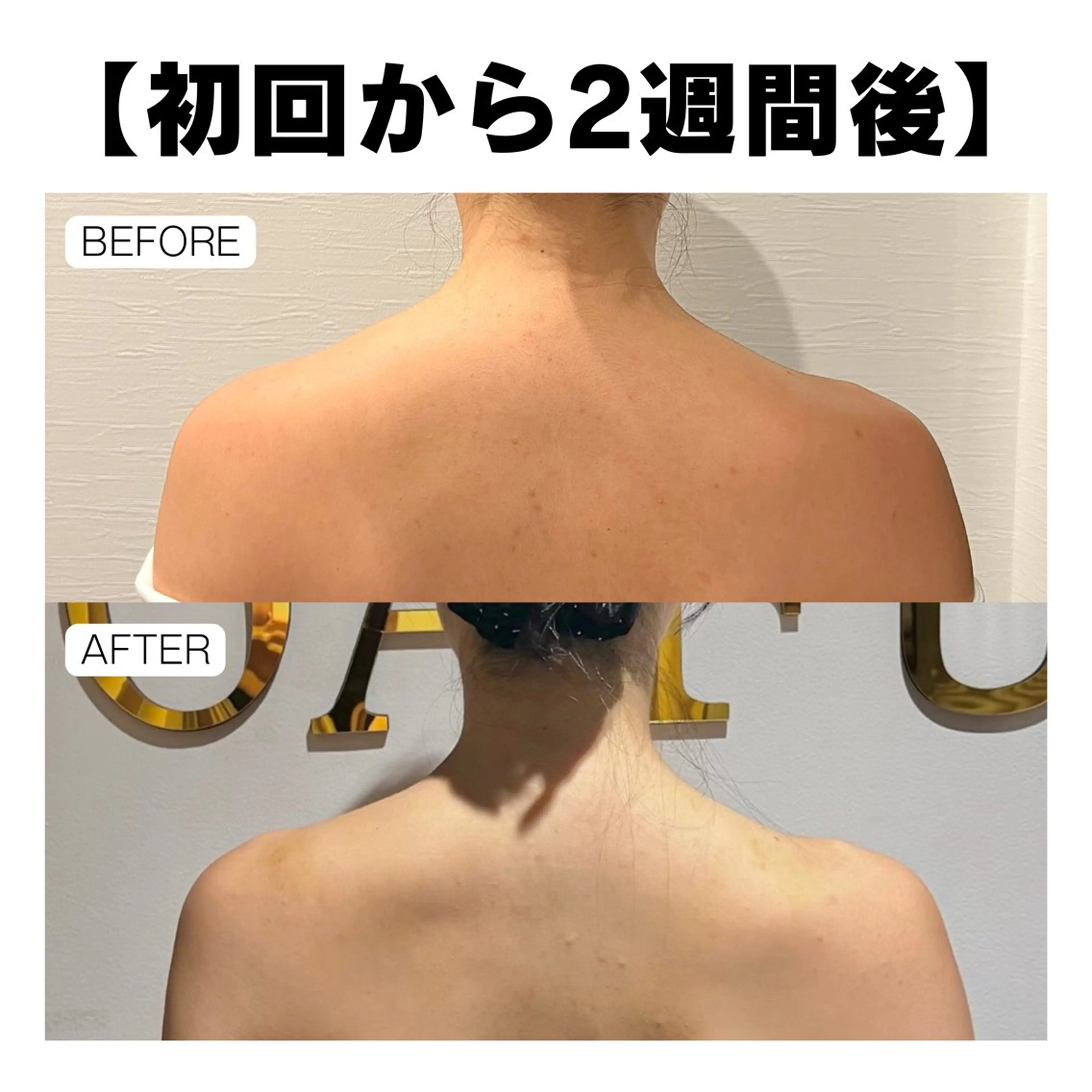 エステ NANIOAFU [本町店]のその他イメージ