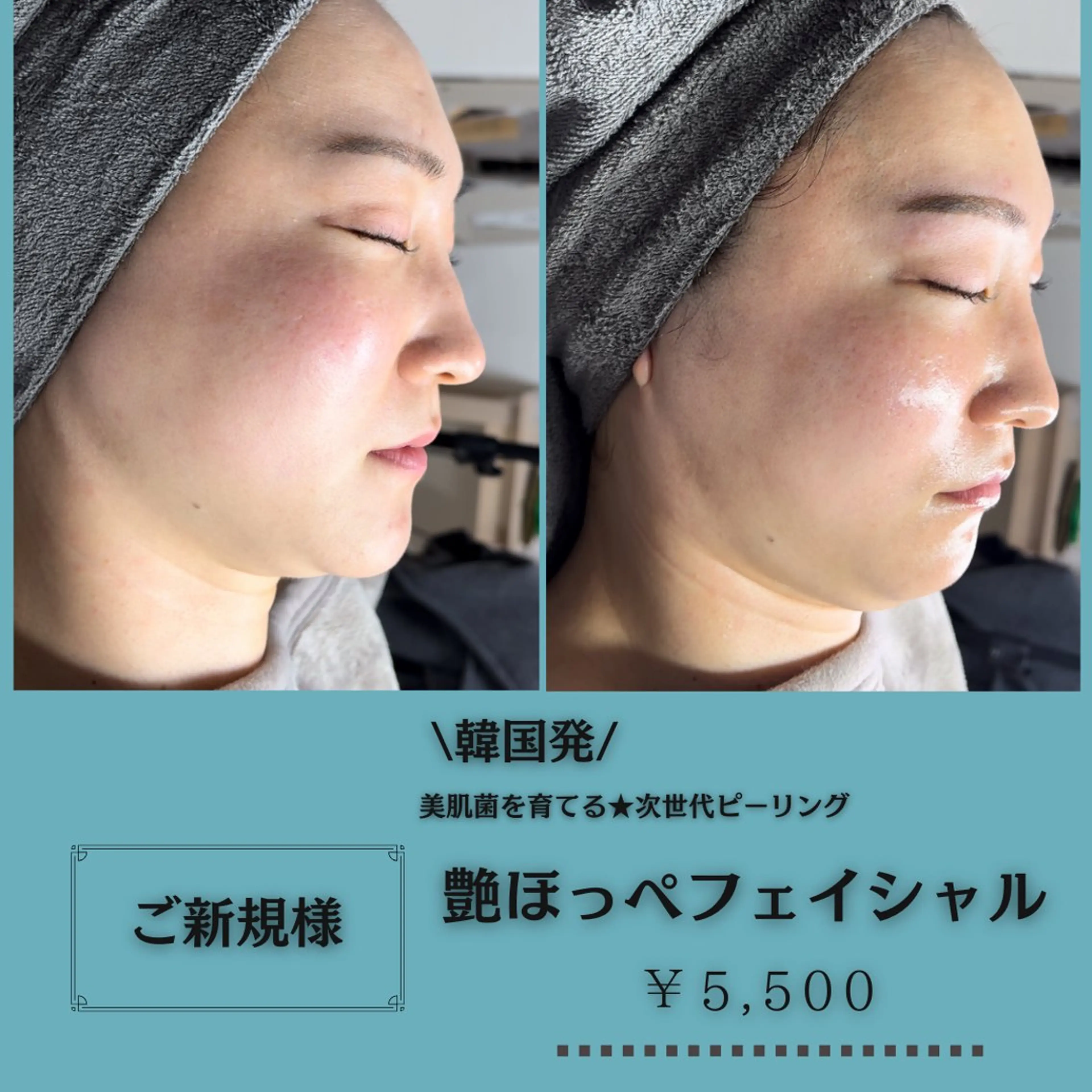 ご新規様★韓国発！次世代ツヤ肌トリートメントの写真
