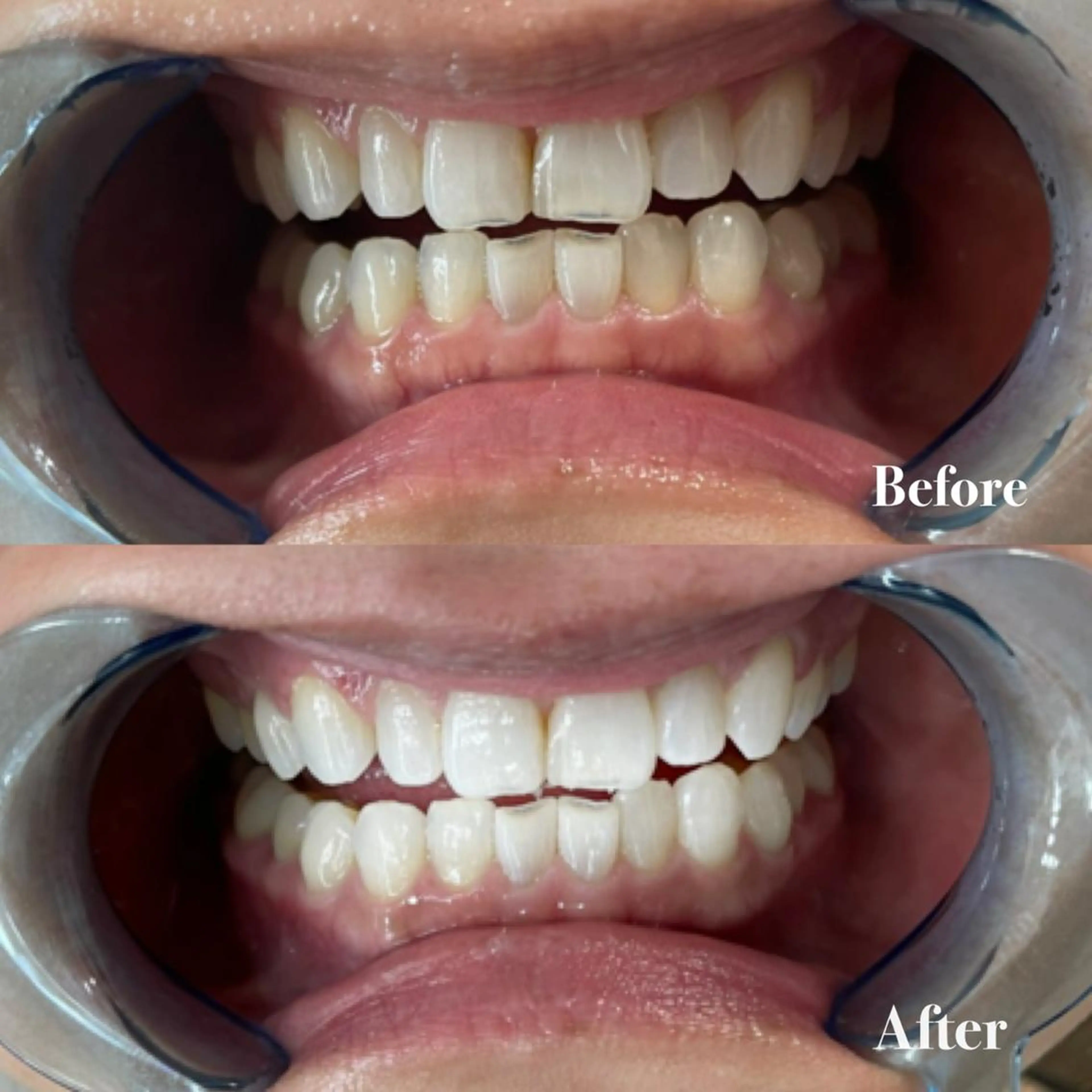 ライトビューティー 銀座店のエステ・リラクイメージ