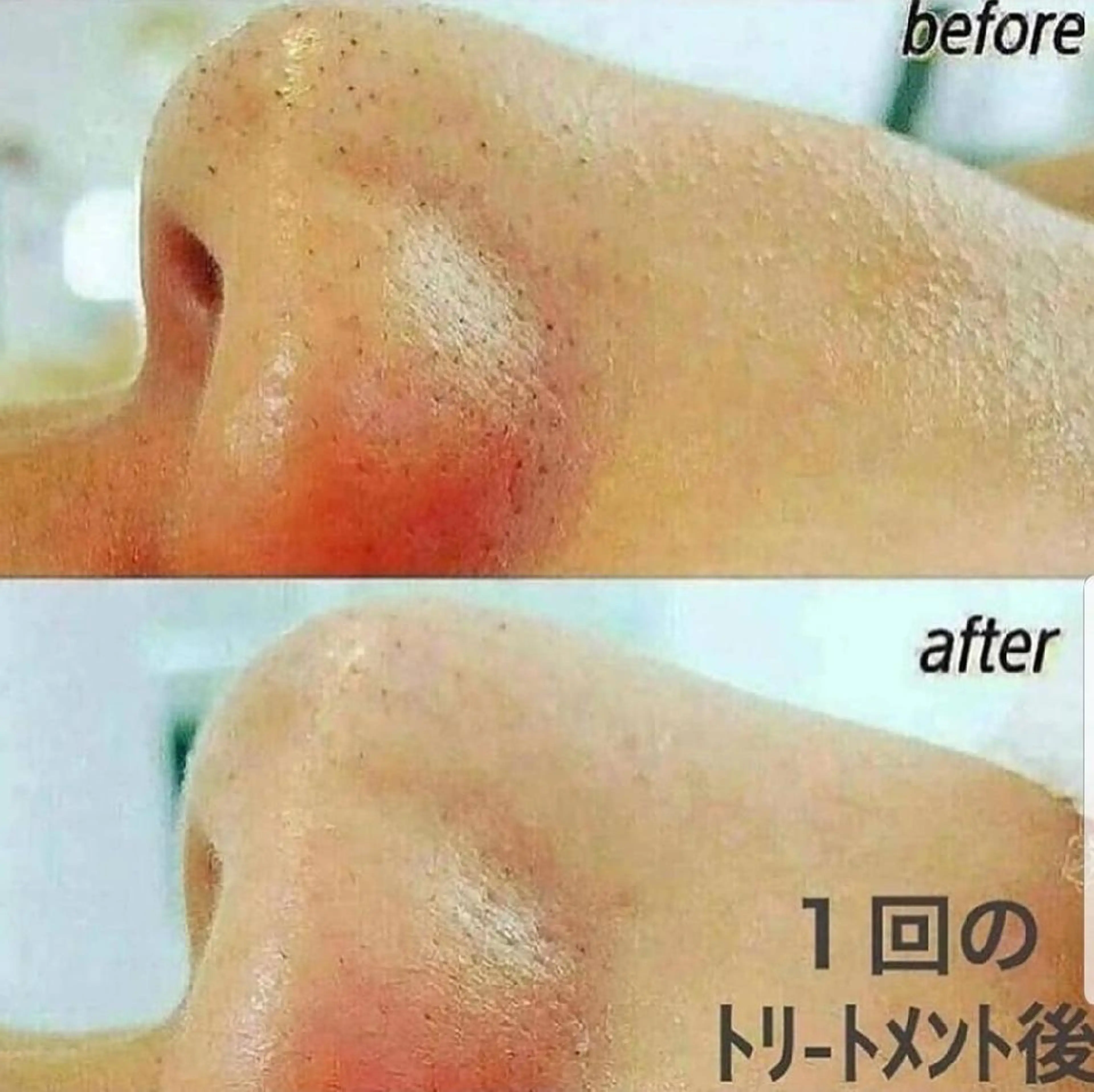 ニキビ・ニキビ跡専門 レゾン京橋店 のエステ・リラクイメージ