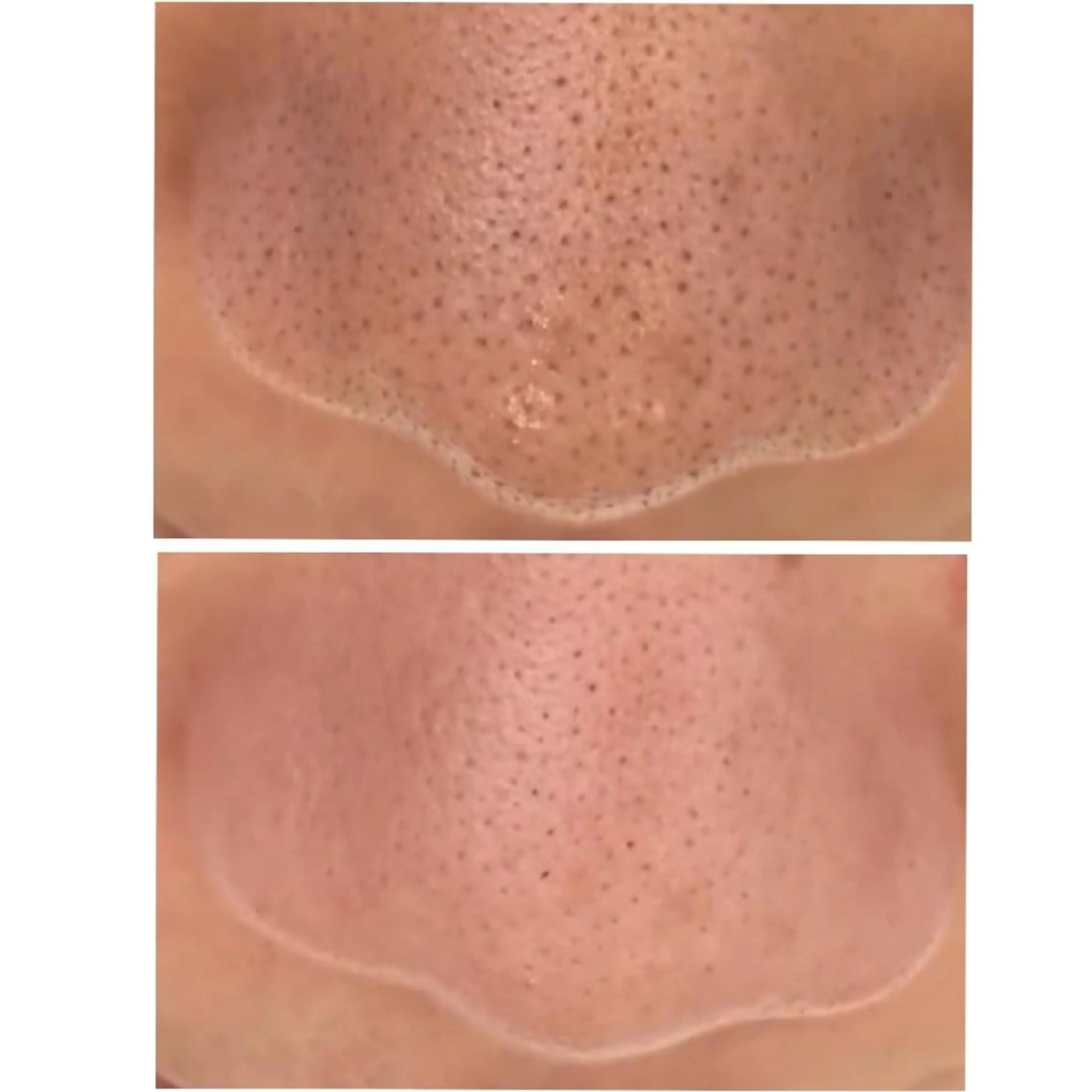 深層リンパオイル/小 顔とドライヘッドスパのエステ・リラクイメージ