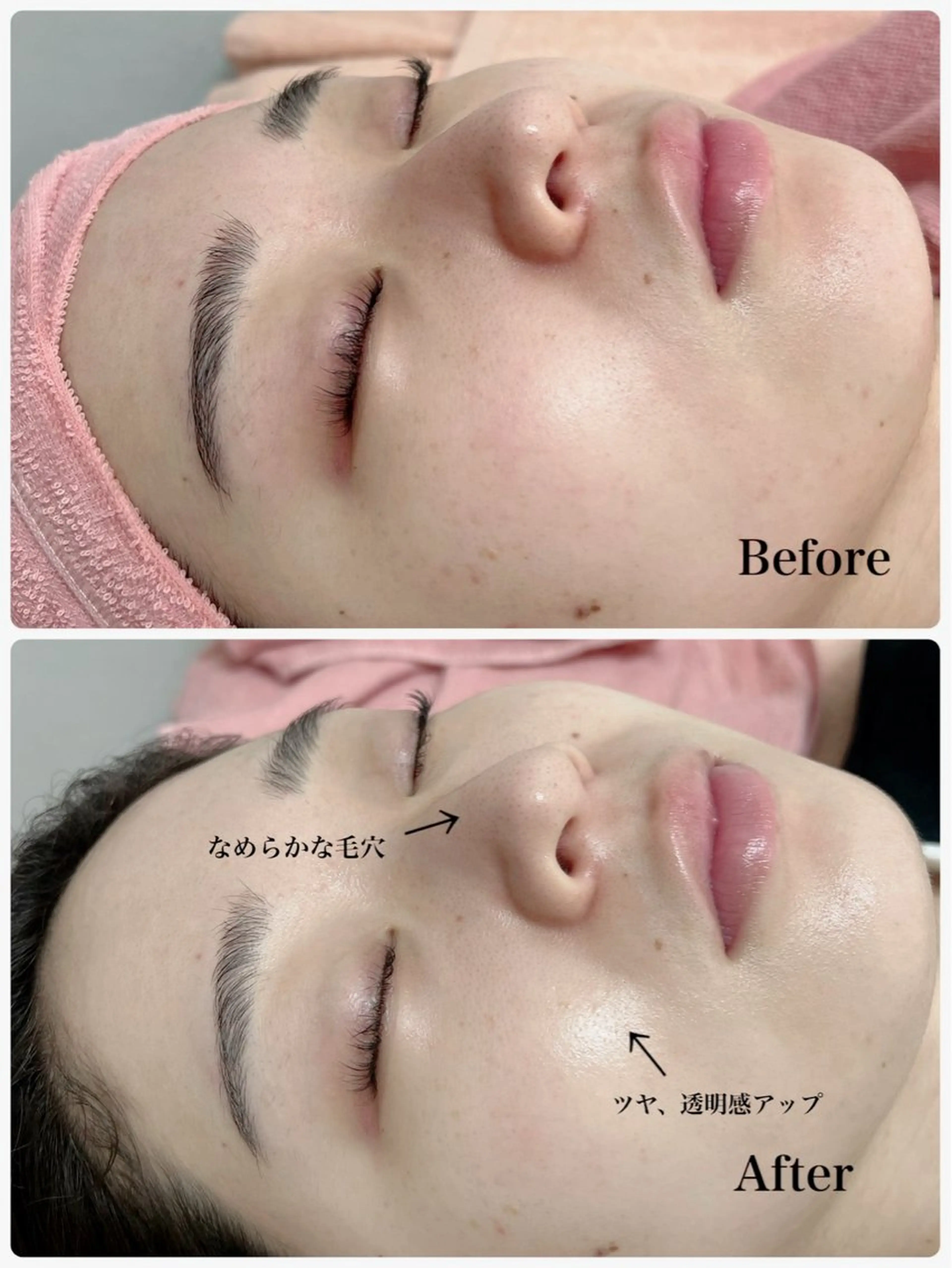 その他 Astorie 相模大野エステのその他イメージ