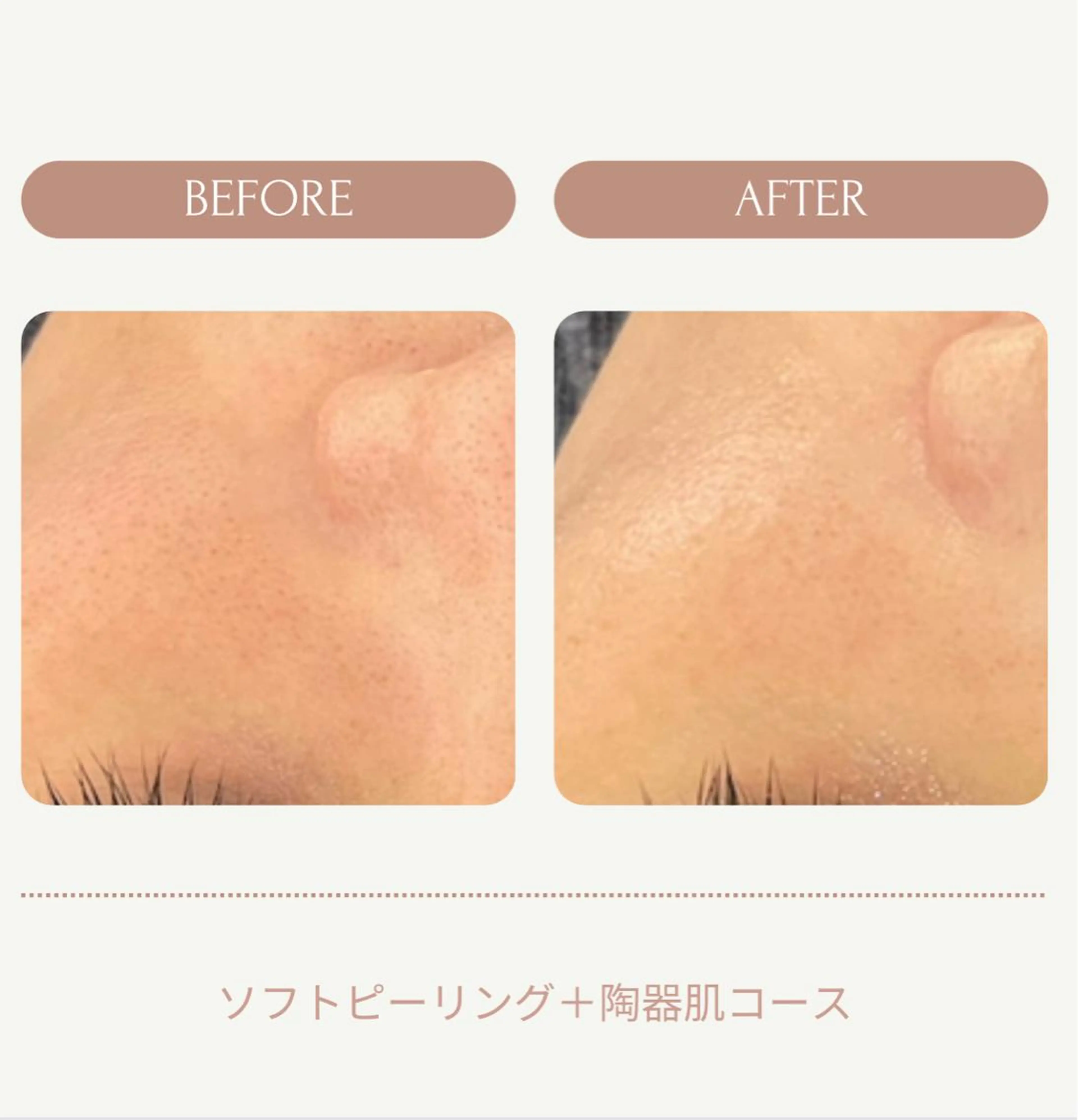 メンズ エステ ヤスダ ユウコのエステ・リラクイメージ