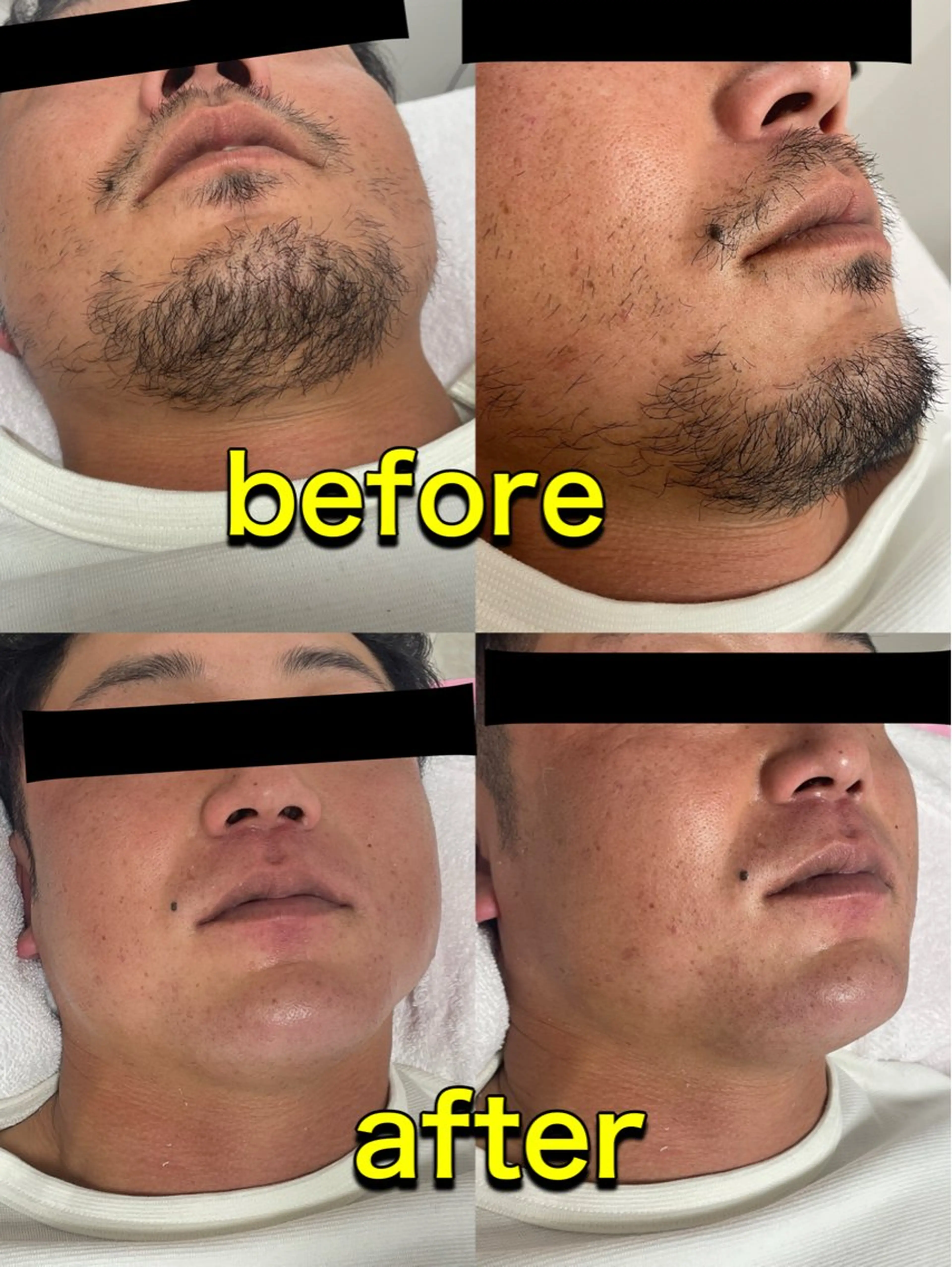 LeaLea_K MIZUKIのマツエク・マツパデザイン