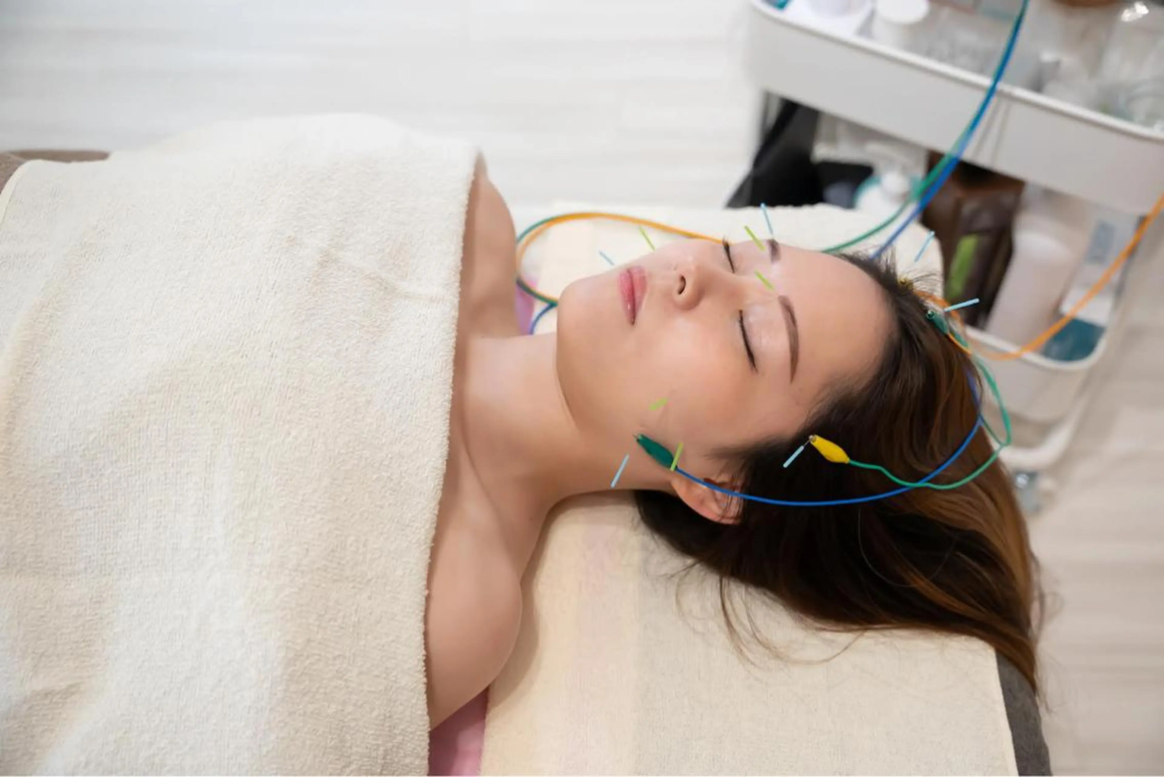 ⭐️1番人気⭐️美顔鍼60分コースの写真