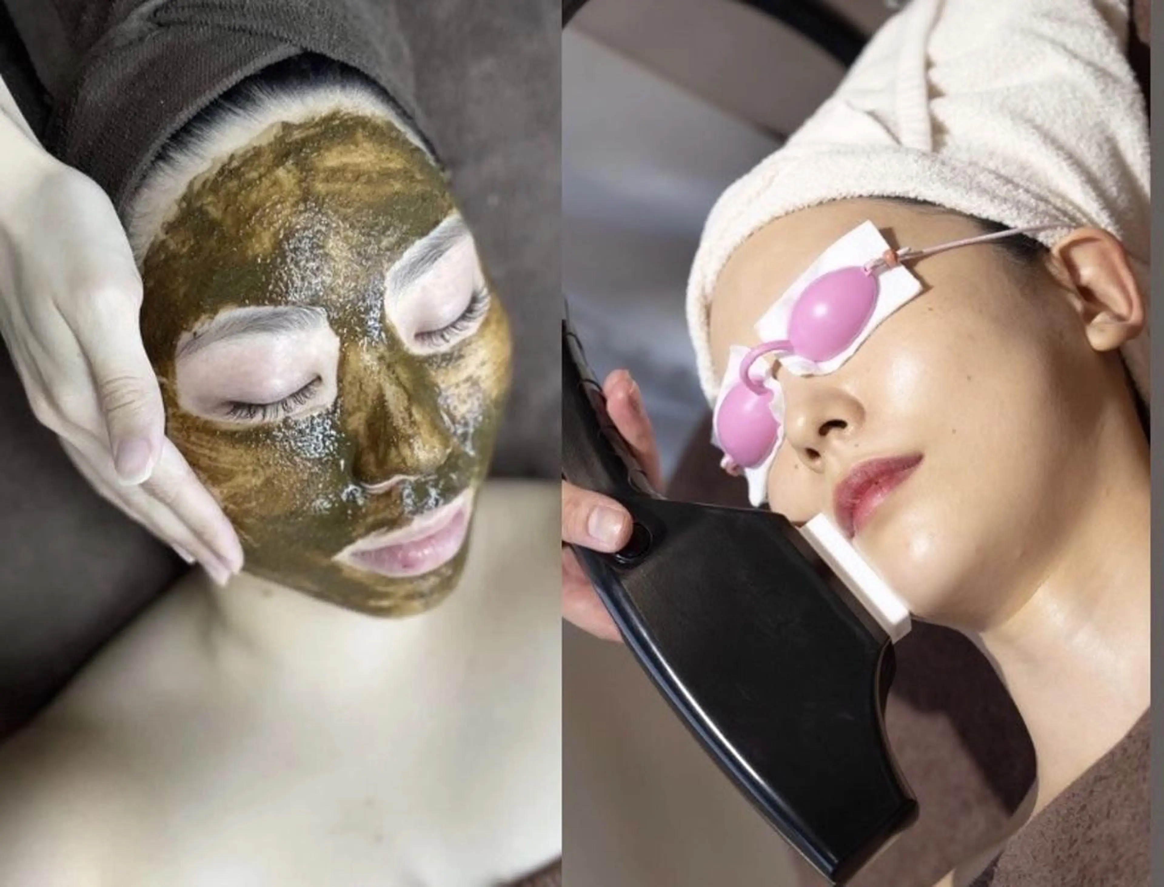 ハーブピーリング RAVIOS 森田のその他イメージ