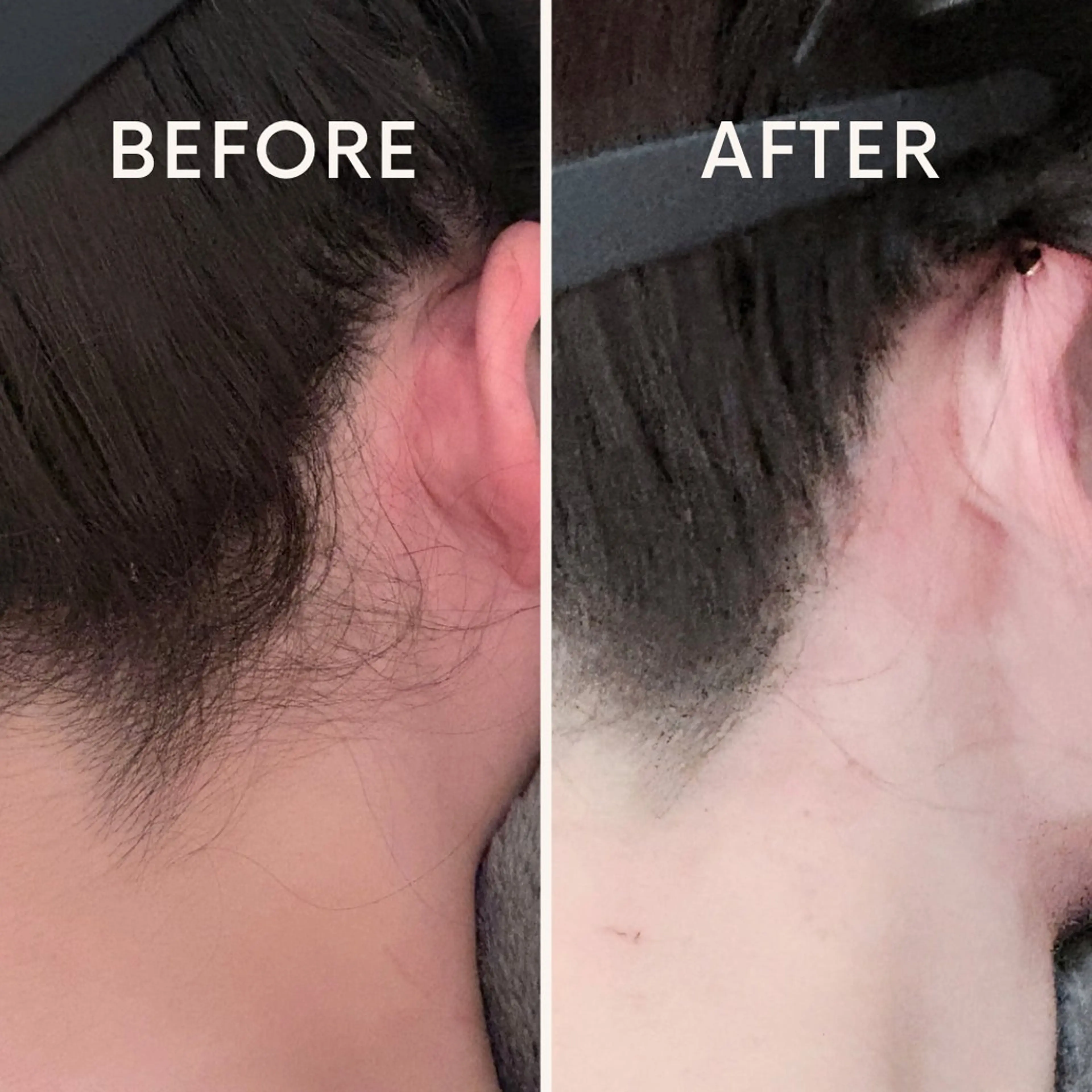 脱毛 🎀RIA🎀 脱毛/フェイシャルのエステ・リラクイメージ