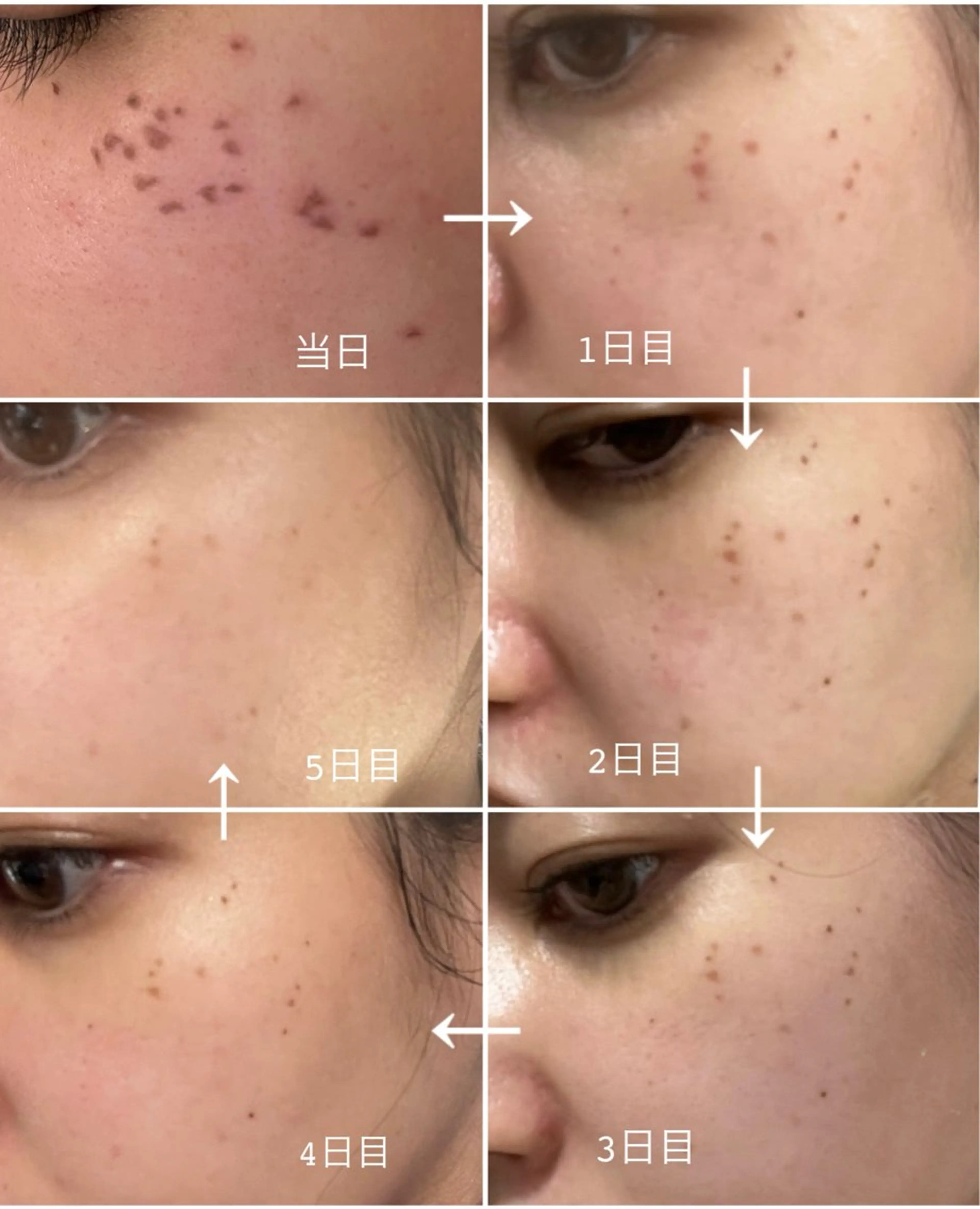 エステ AnLimit 當山杏奈のエステ・リラクイメージ