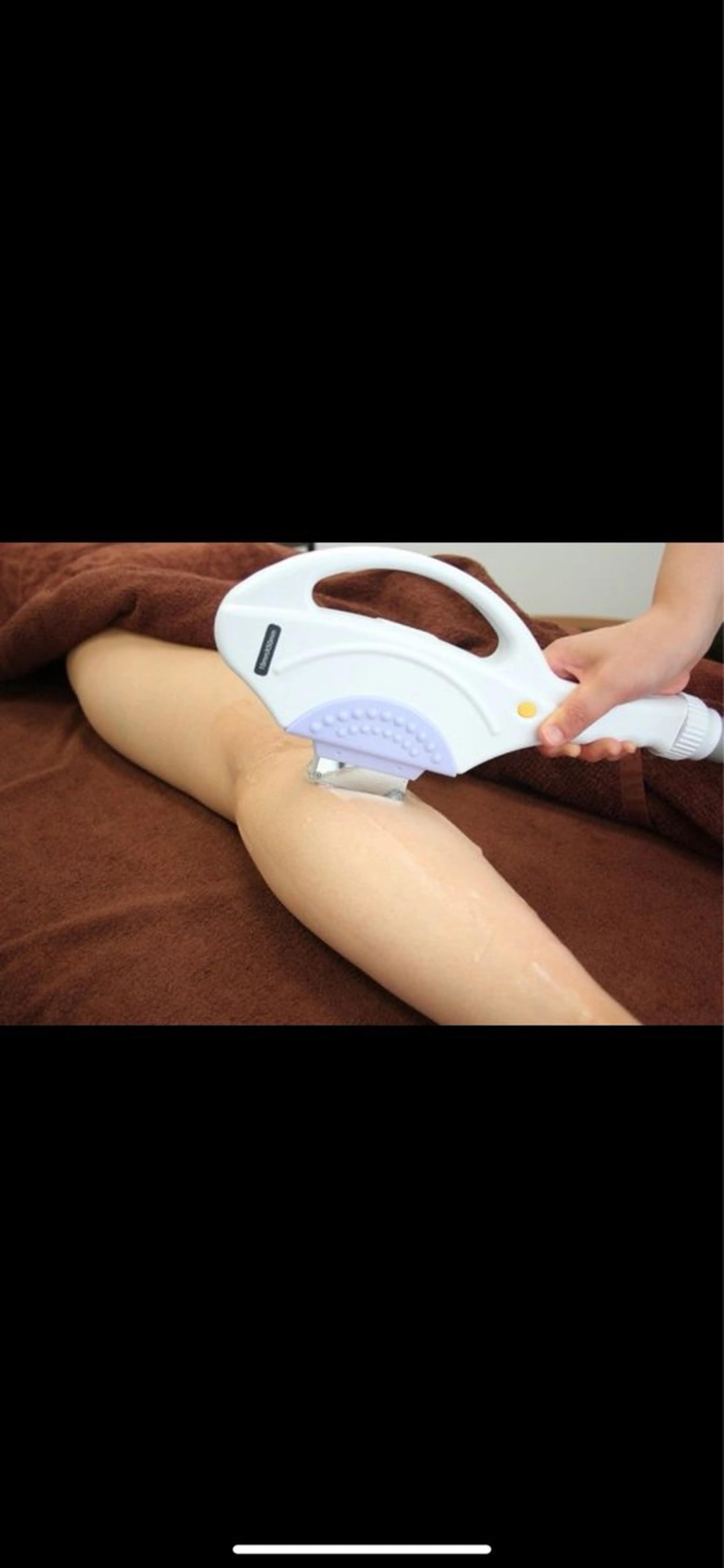 脚ヒカリ脱毛7700円→３３００円の写真