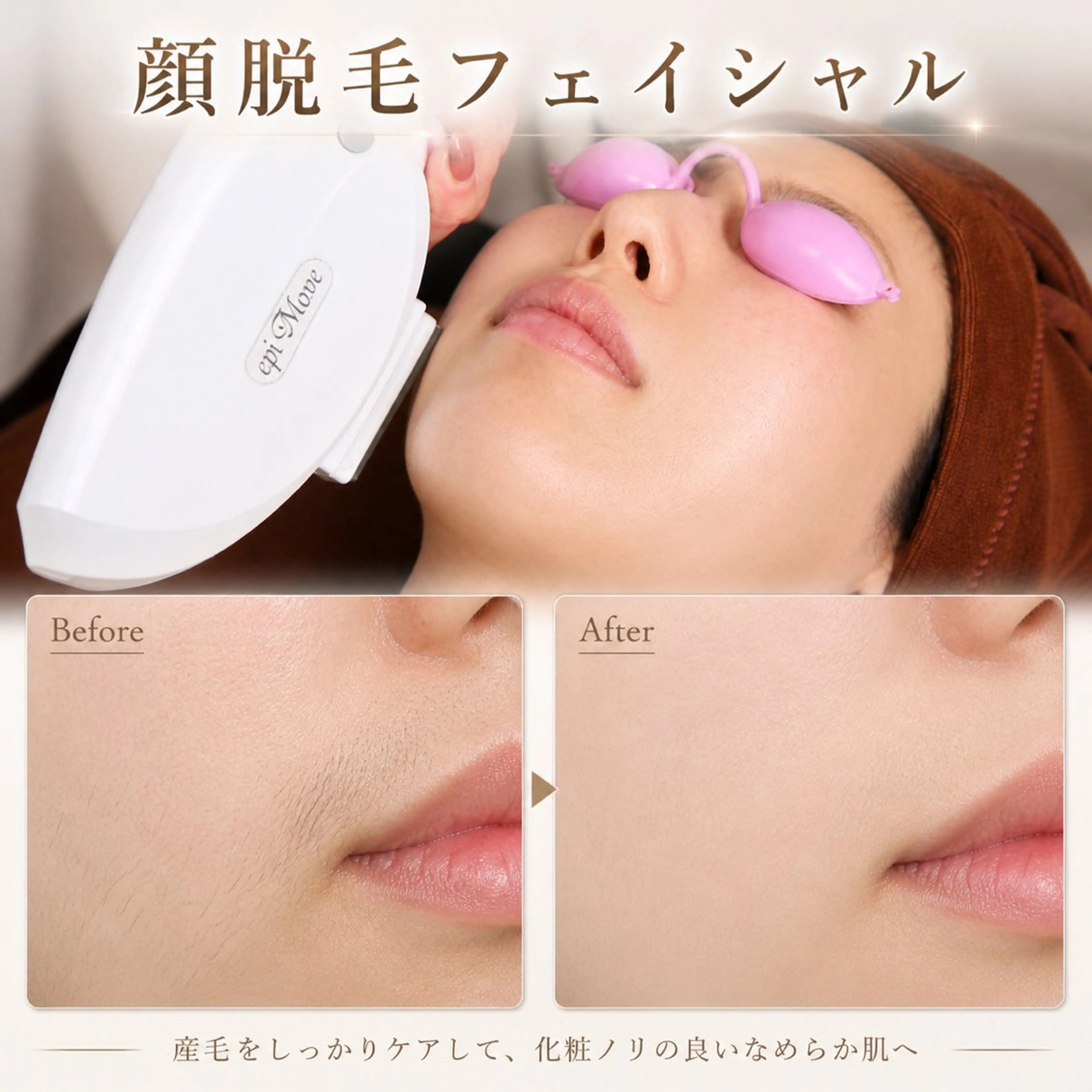 minimo限定🫧✨【産毛・くすみ・肌荒れ改善】光顔脱毛フェイシャル💎の写真