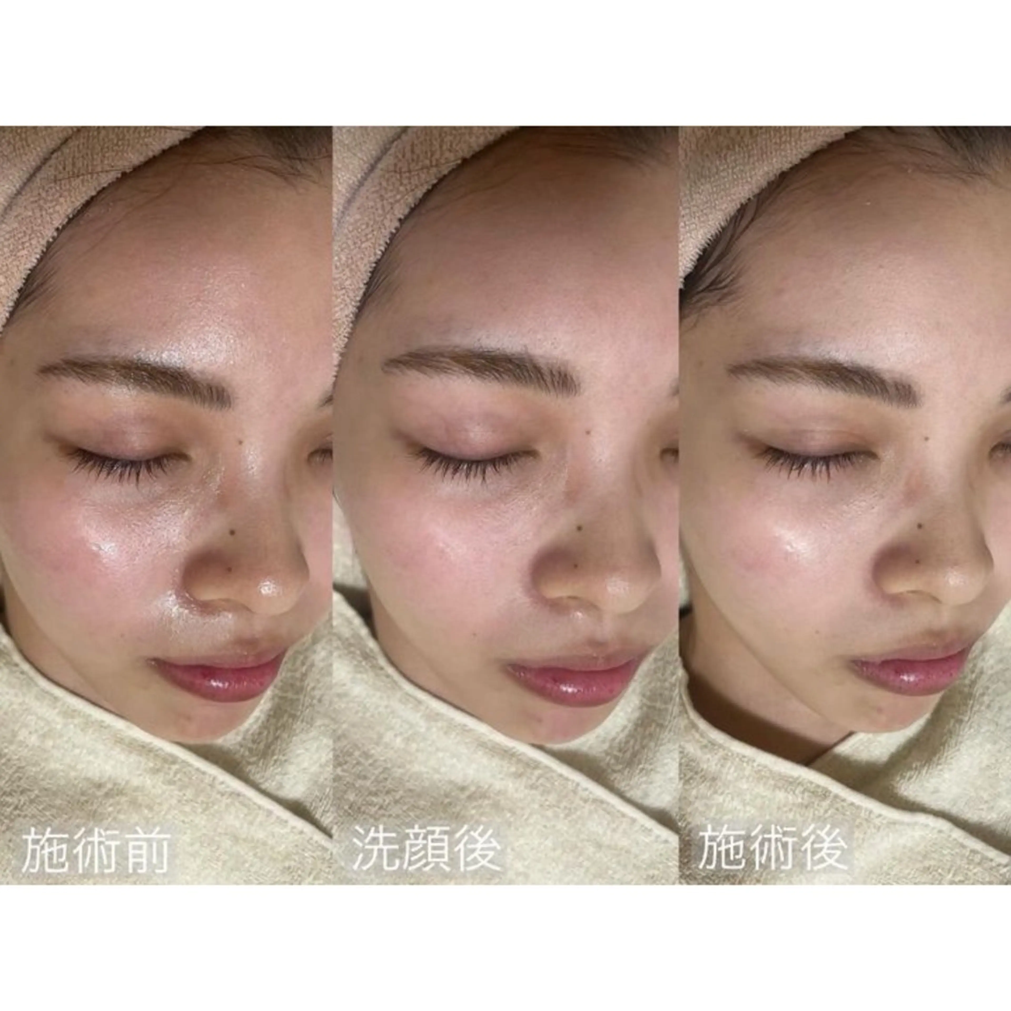 エステ アイブロウ&フェイシャルサロンa‘lm所属・WAX脱毛/肌質改善 眉毛とお肌のサロンのエステ・リラクイメージ