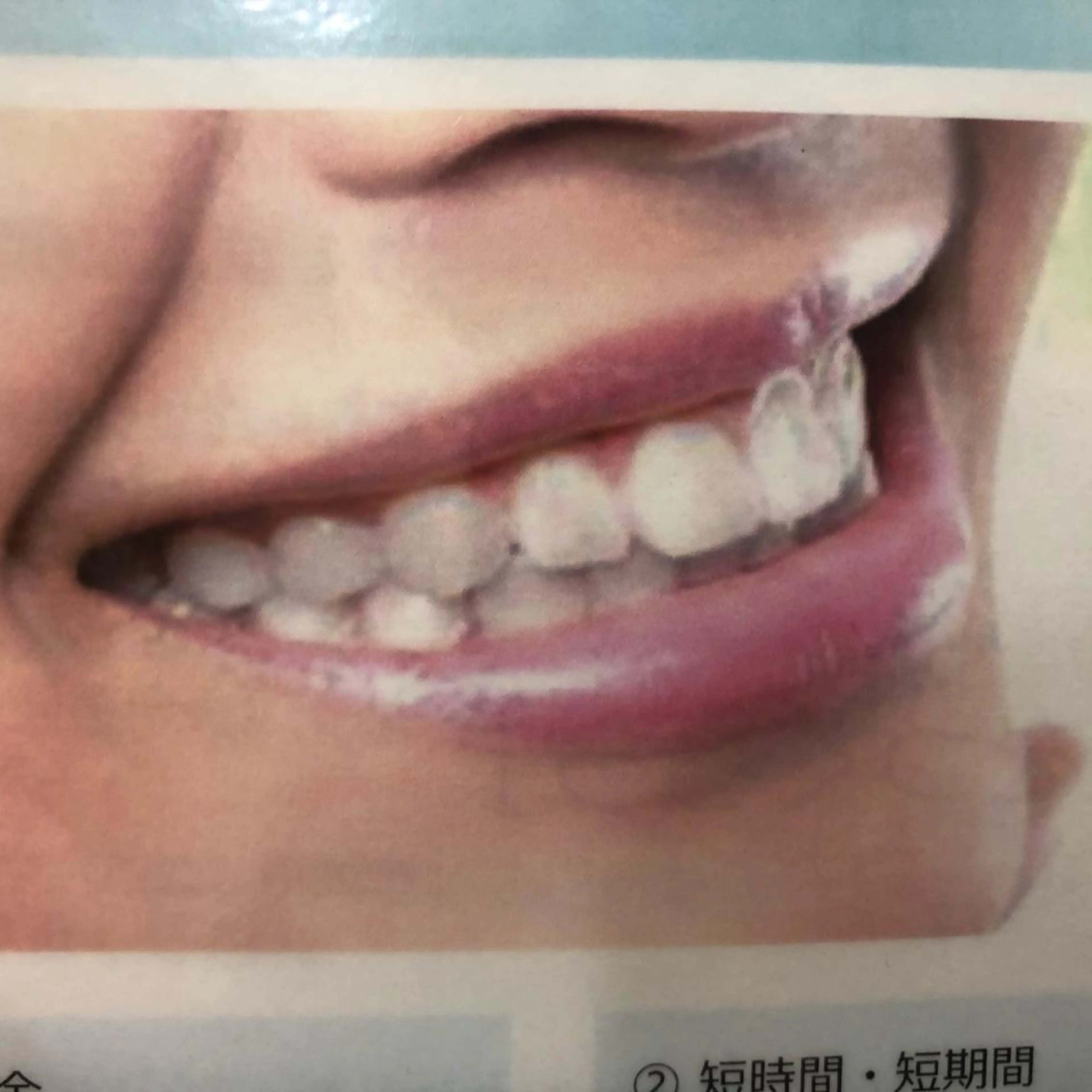 雪上 章のヘアスタイル