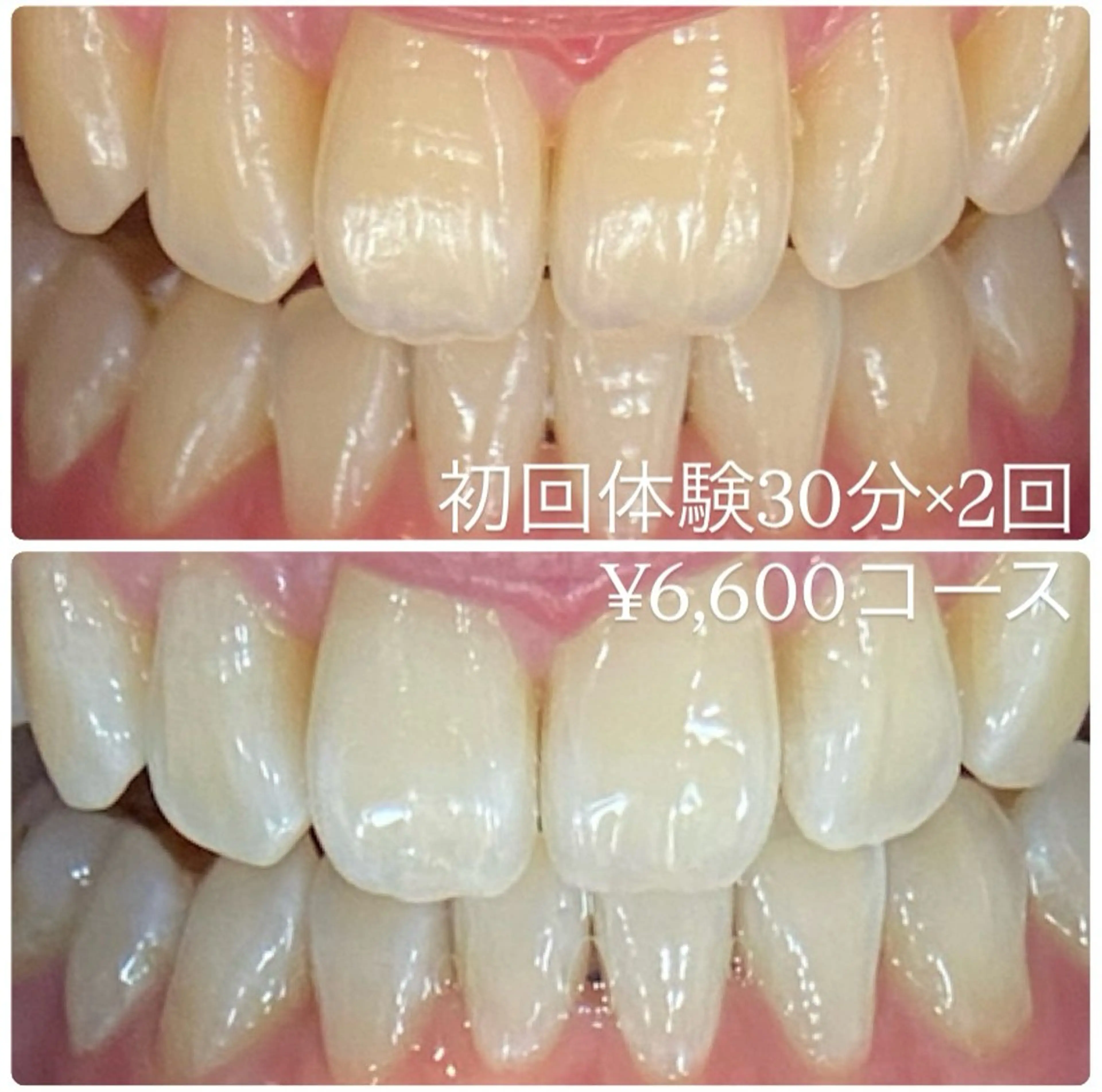 ホワイトニングルーム 横浜店のその他イメージ