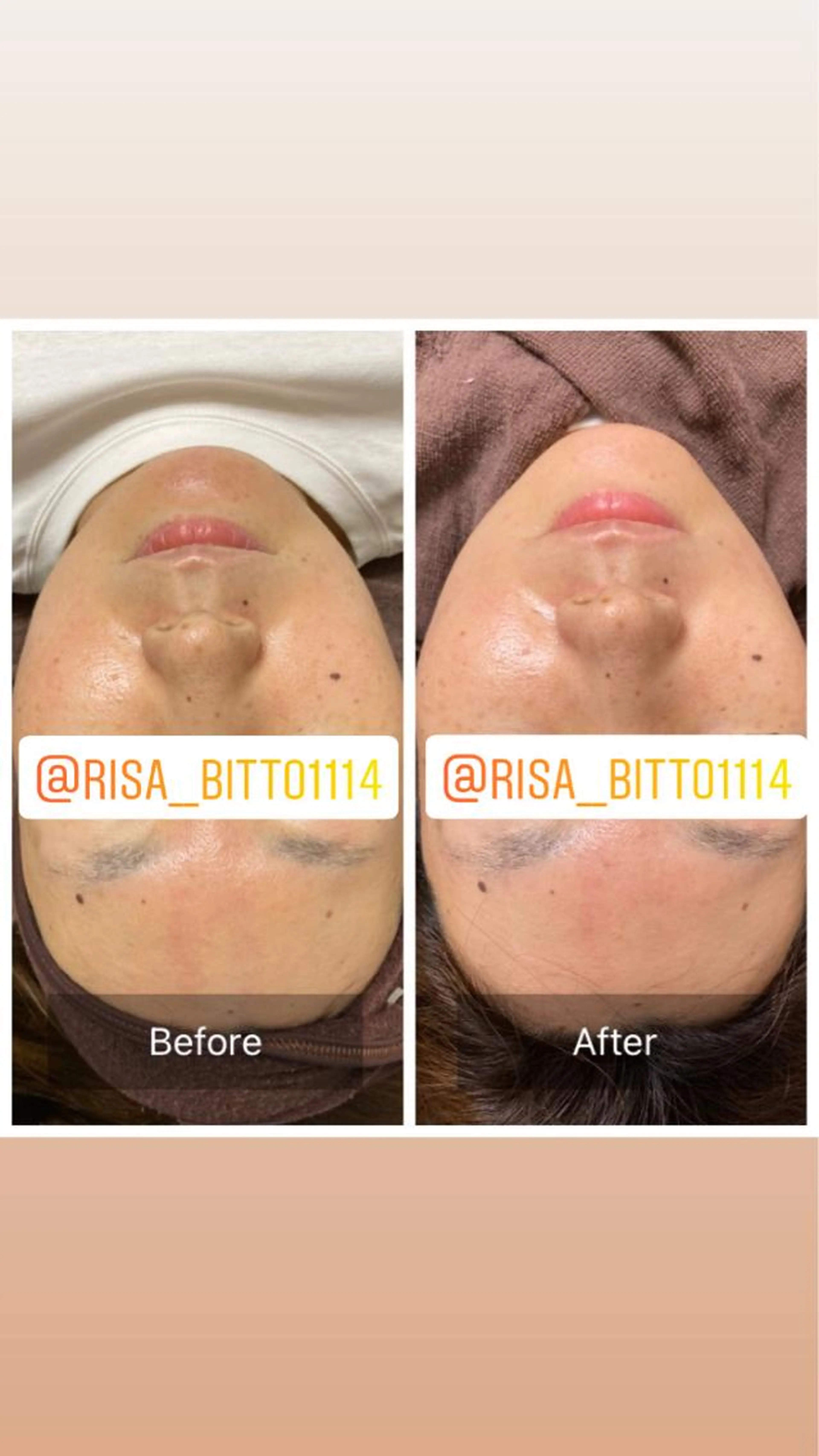 フェイスWaxの写真