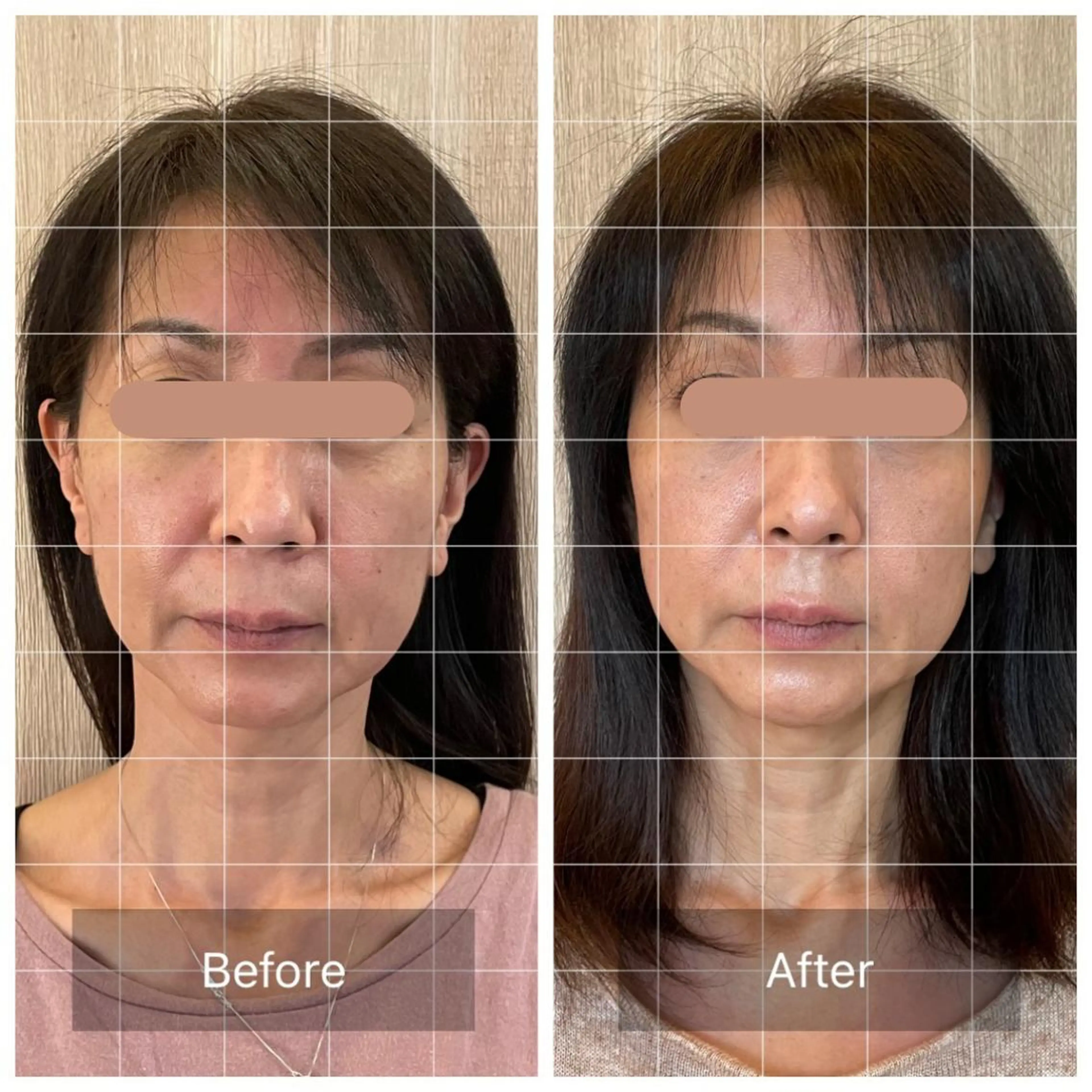 ///Rehari 本町Makiのその他イメージ