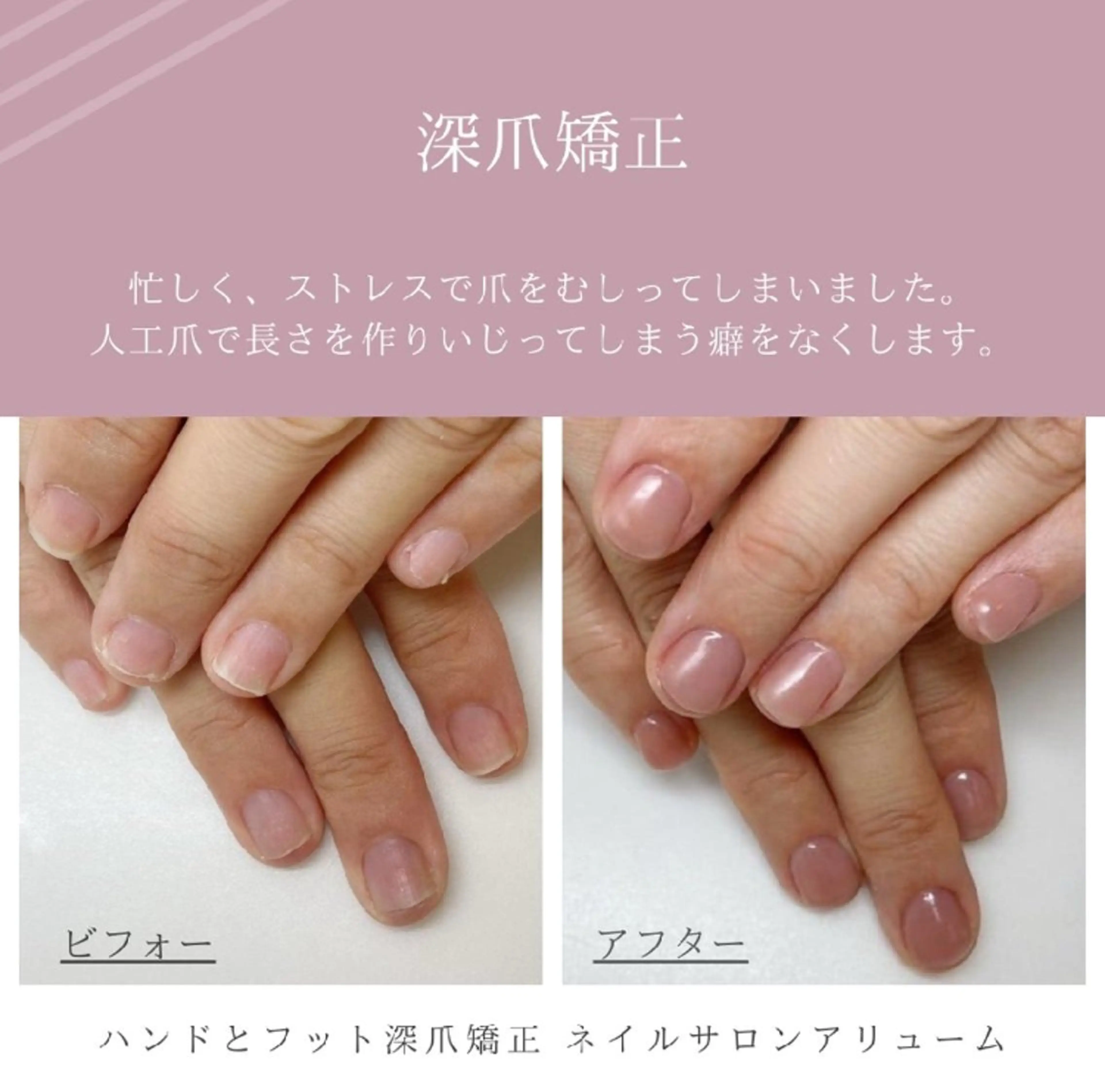 ネイル ネイルサロン アリュームのネイルデザイン