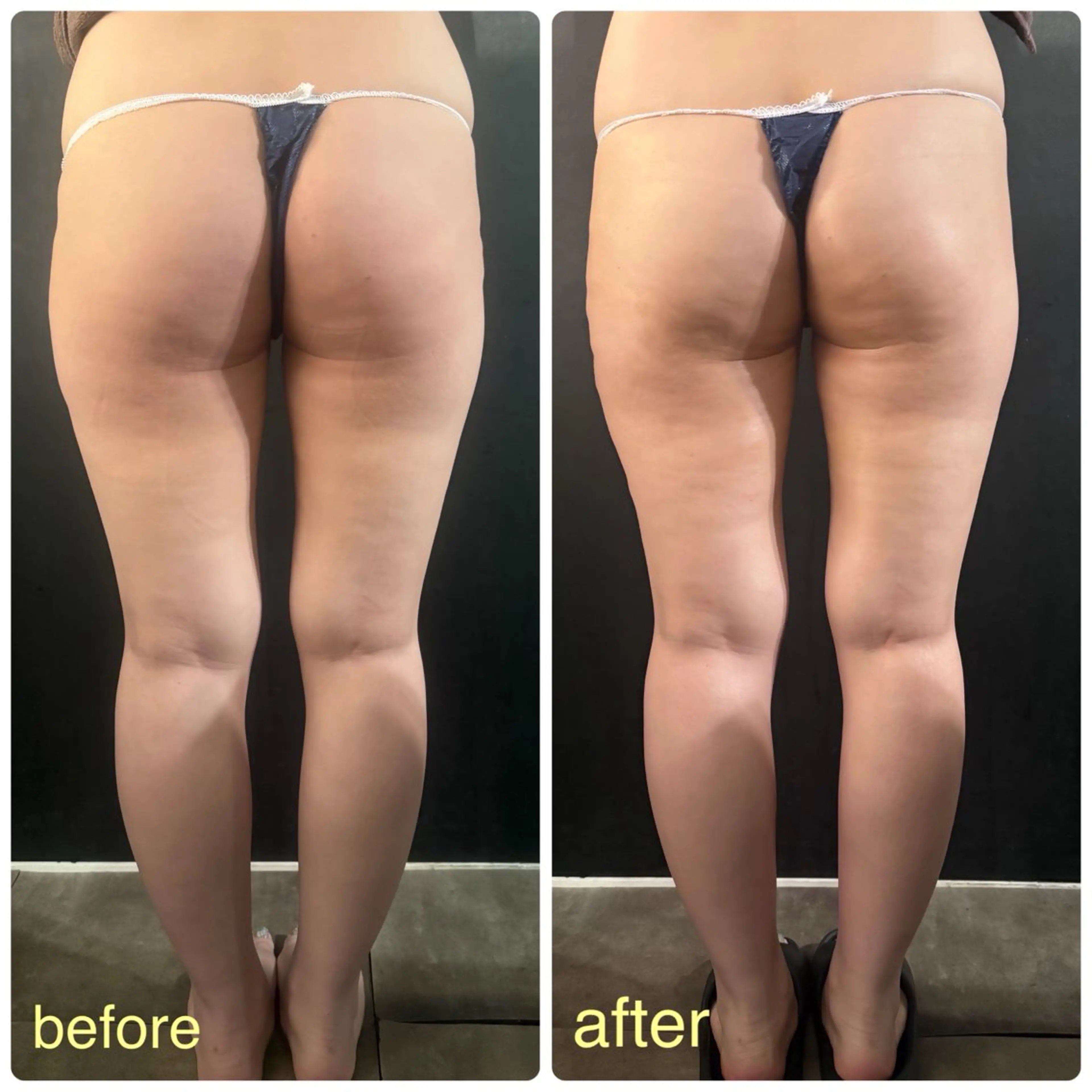 Cocofran/ manatsuのエステ・リラクイメージ