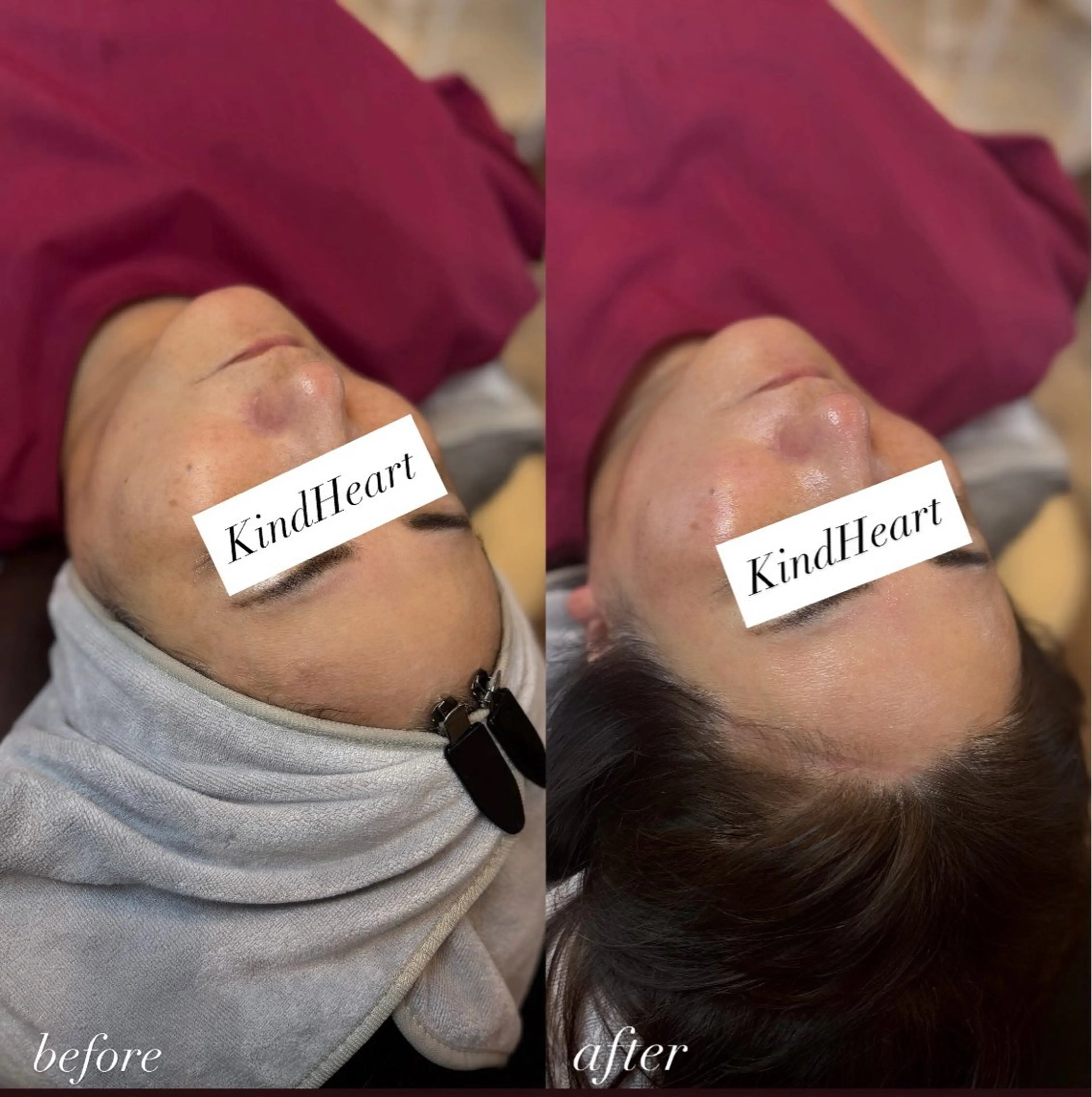 脱毛 Salon KindHeartの眉毛・アイブロウイメージ