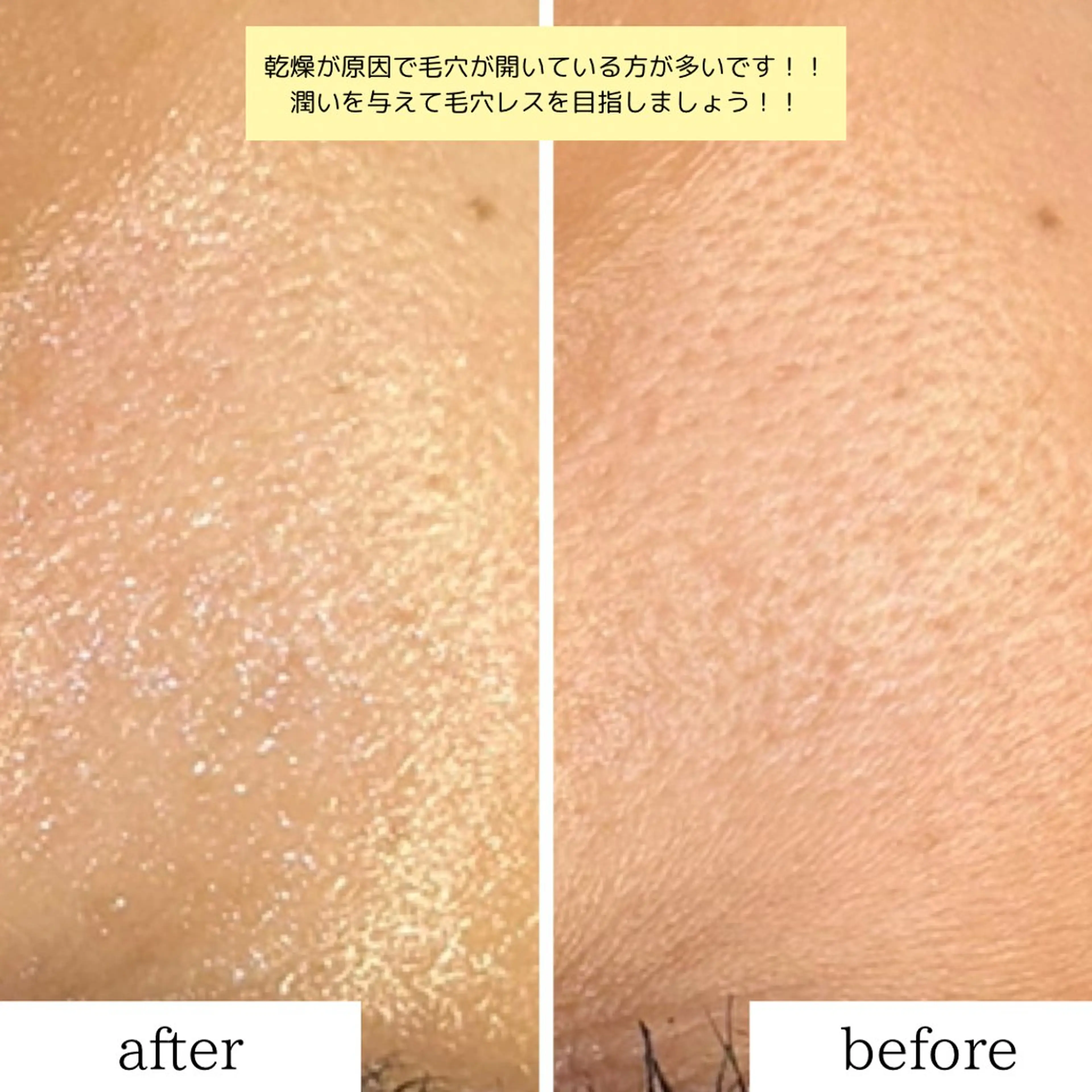 leolo武蔵浦和 肌質改善＆脱毛のエステ・リラクイメージ