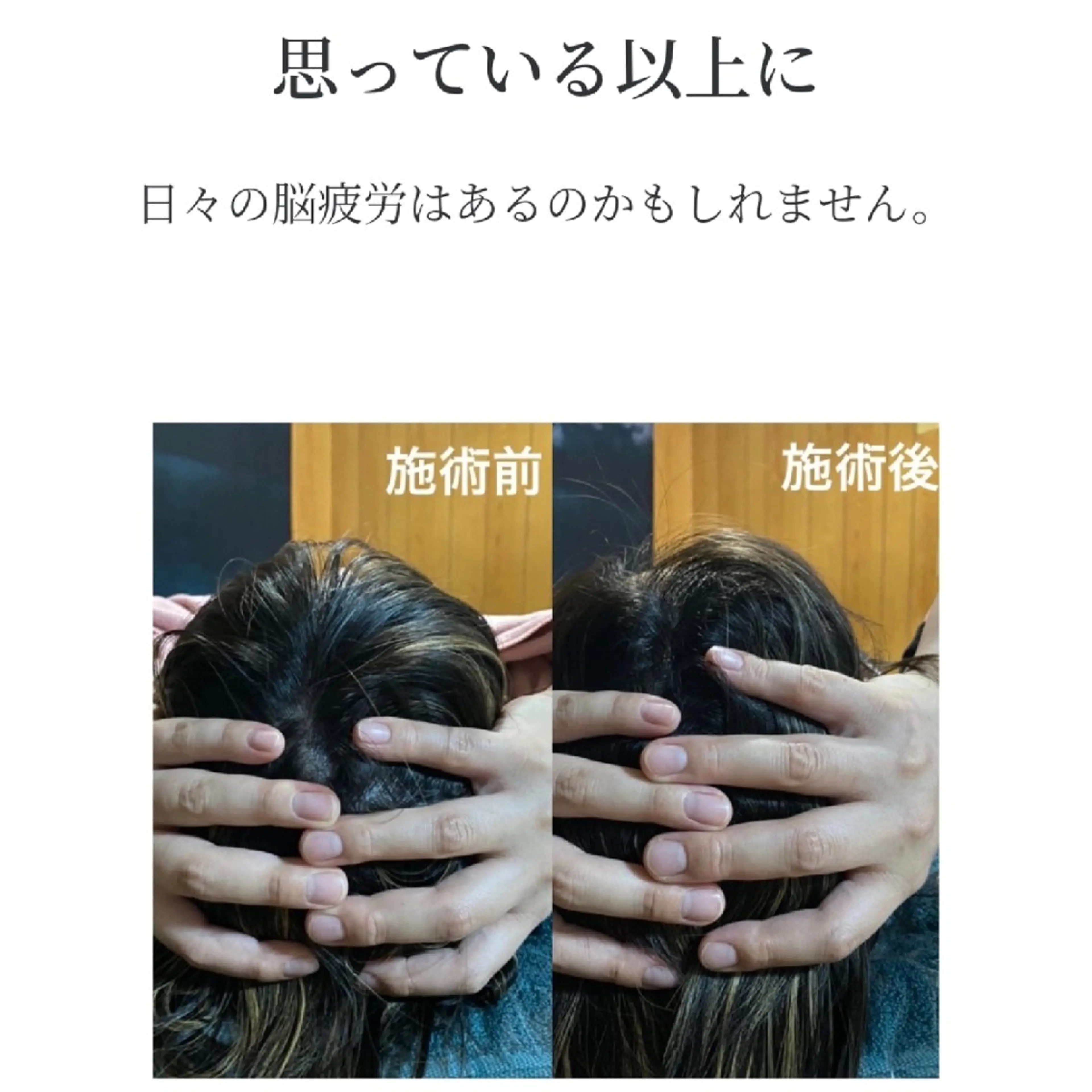 おすすめセットケアの写真