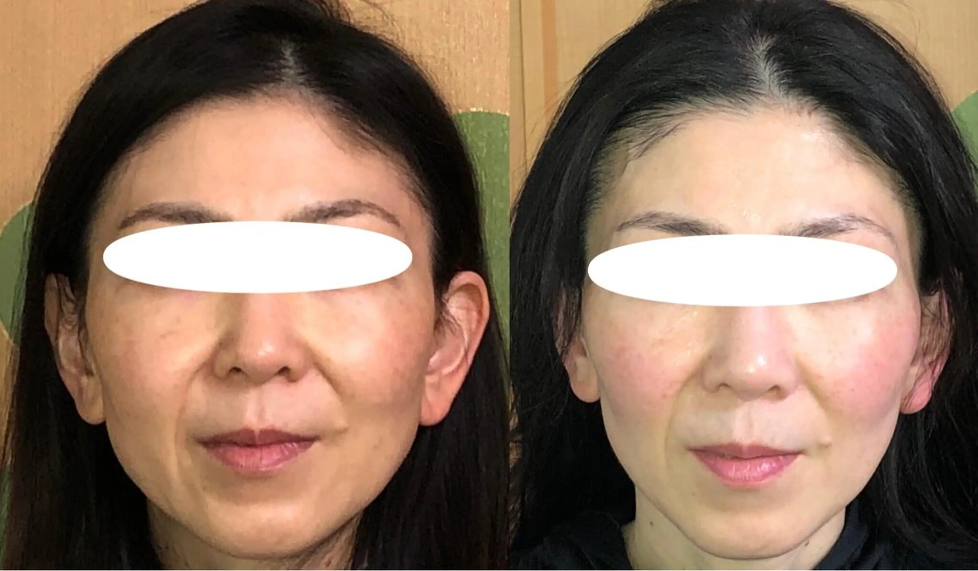 エステ リラク 春日井トータルからだ サロンふくふくのエステ・リラクイメージ